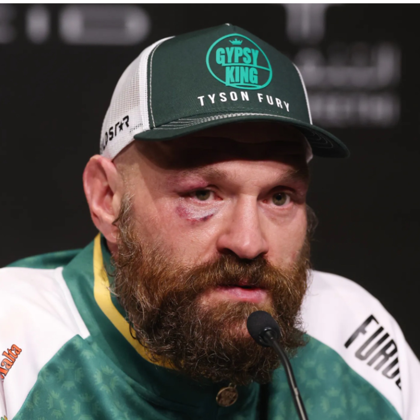 Another Fury is back pod