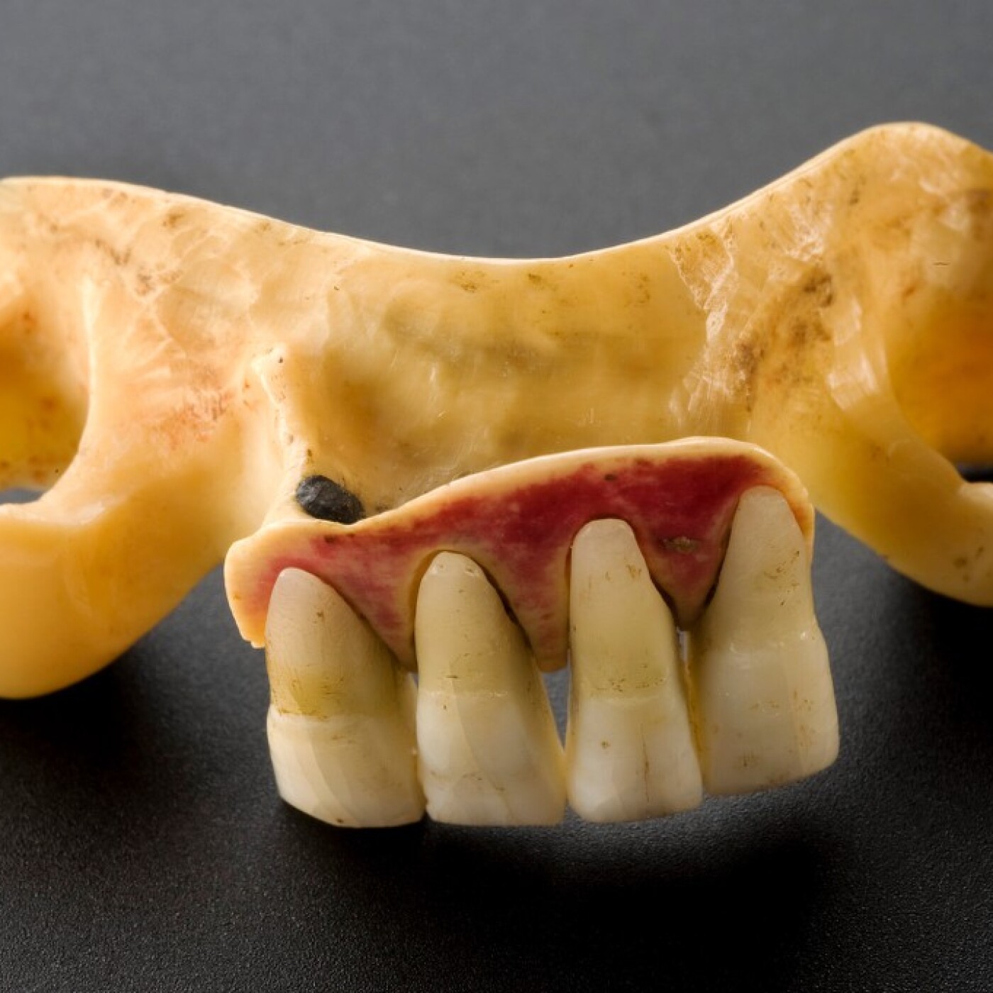 Dentiers en dents de cadavre - Waterloo teeth