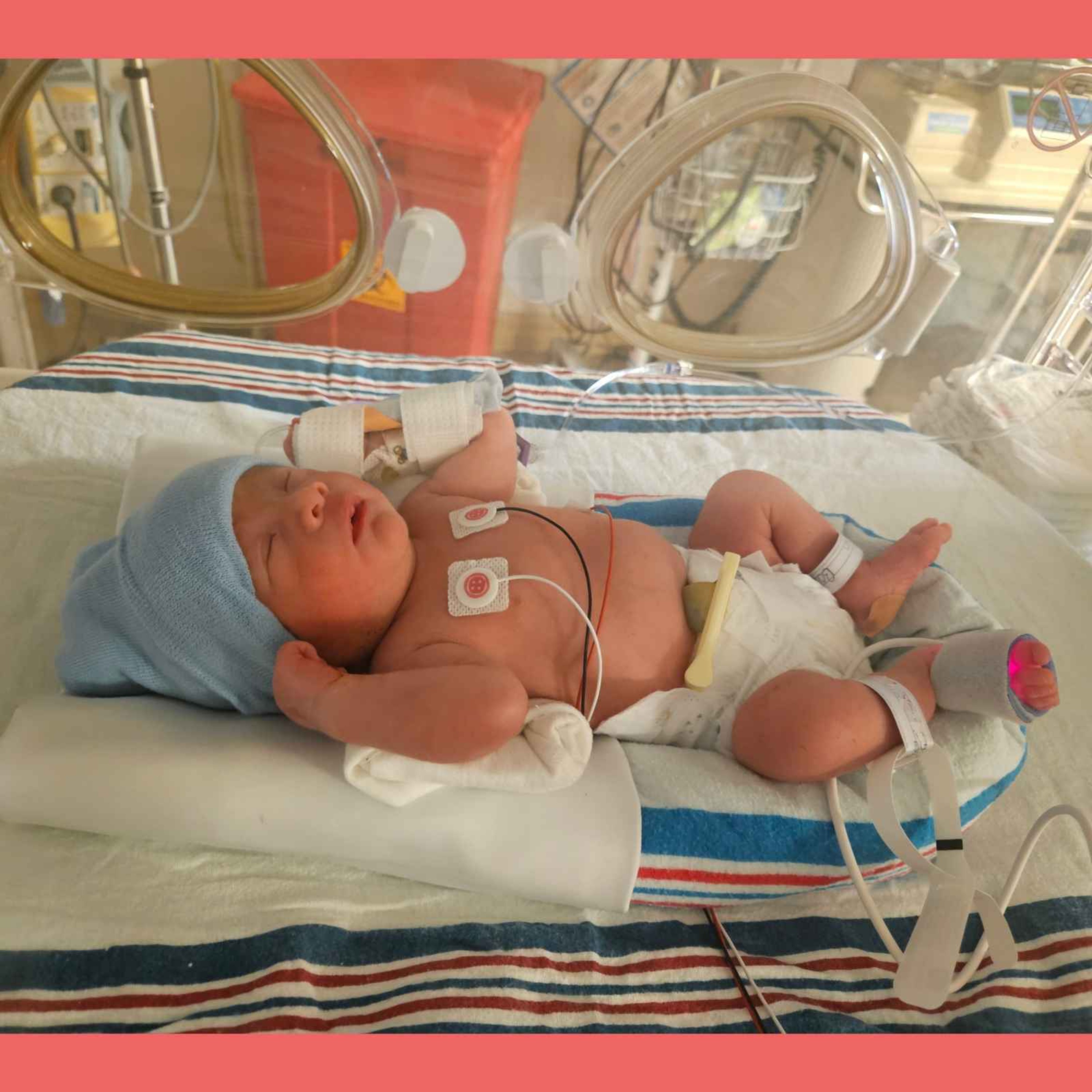 36. 新生儿重症监护室 | Life in the NICU