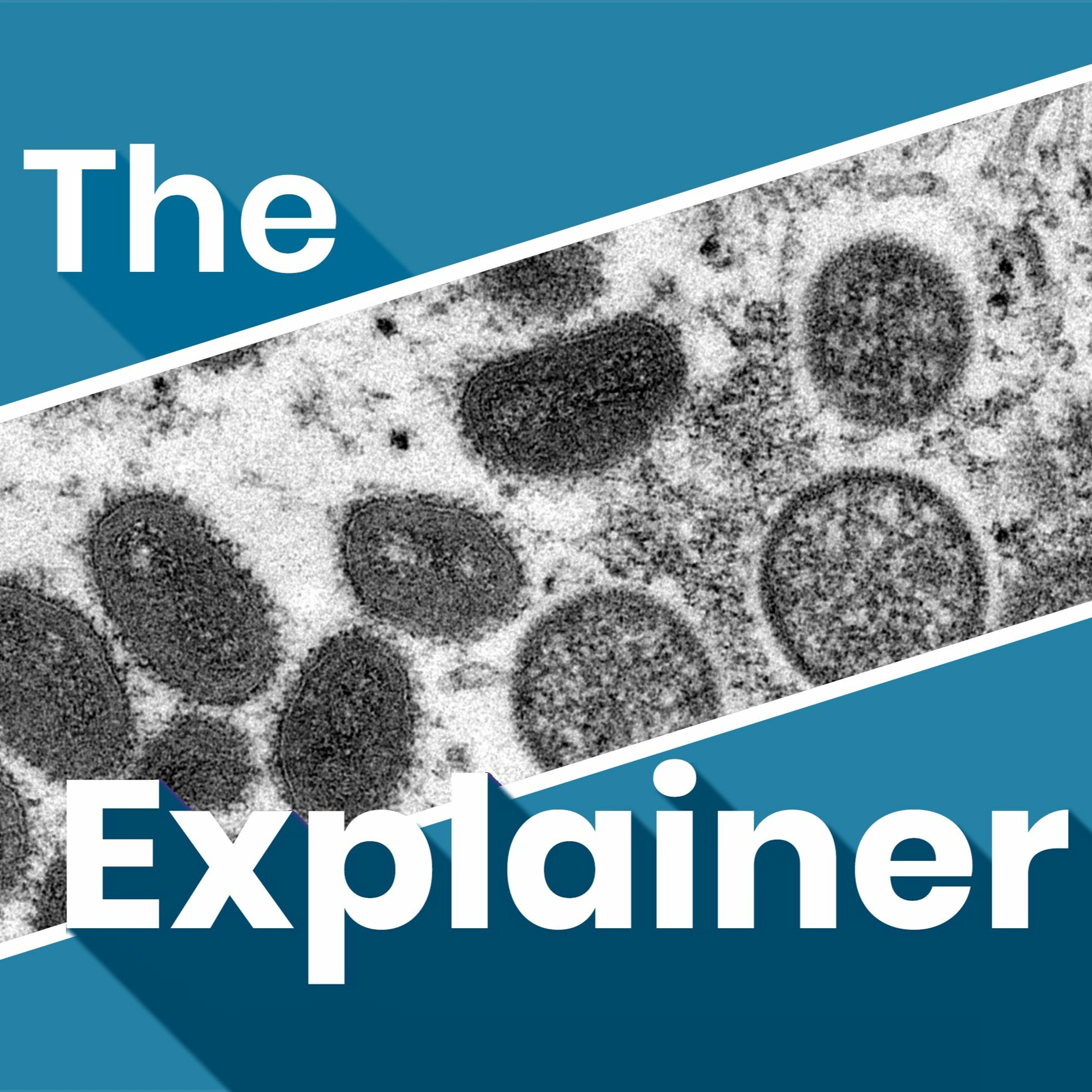 The Explainer