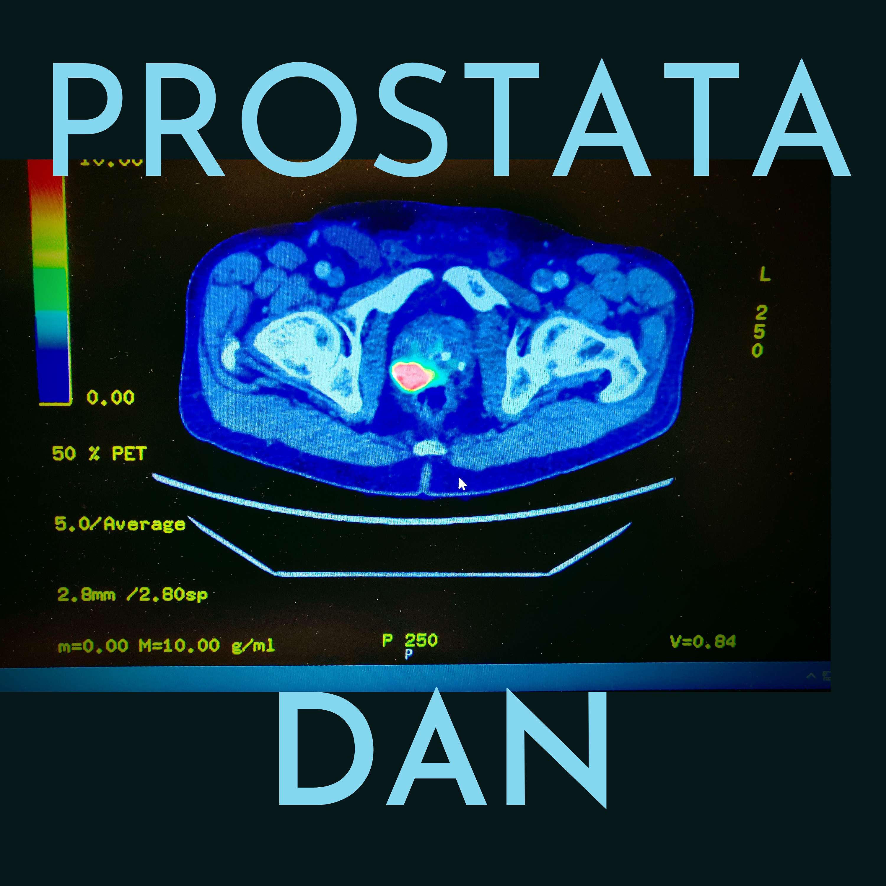 PROSTATA DAN