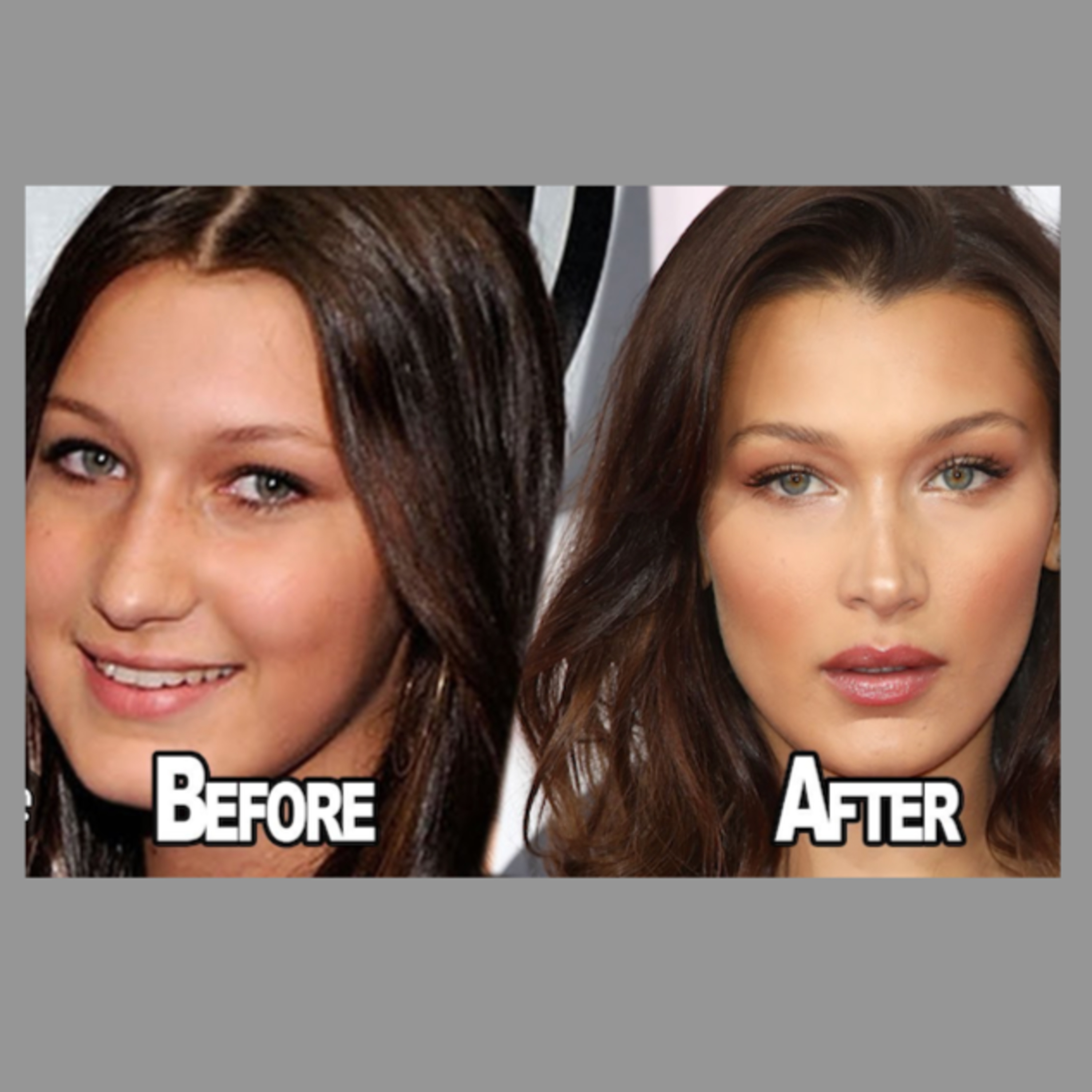 Les secrets de la chirurgie du visage