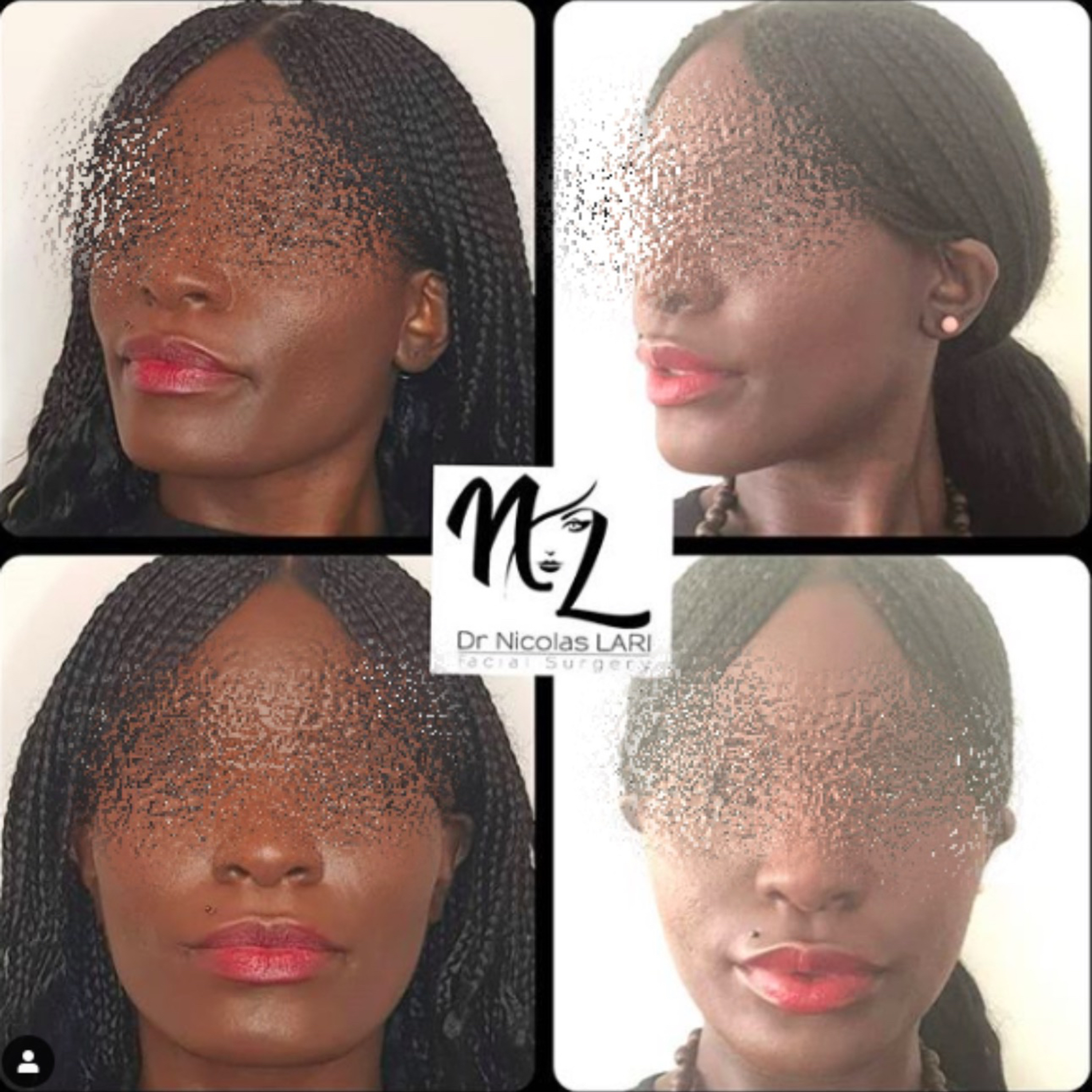 Les secrets de la chirurgie du visage