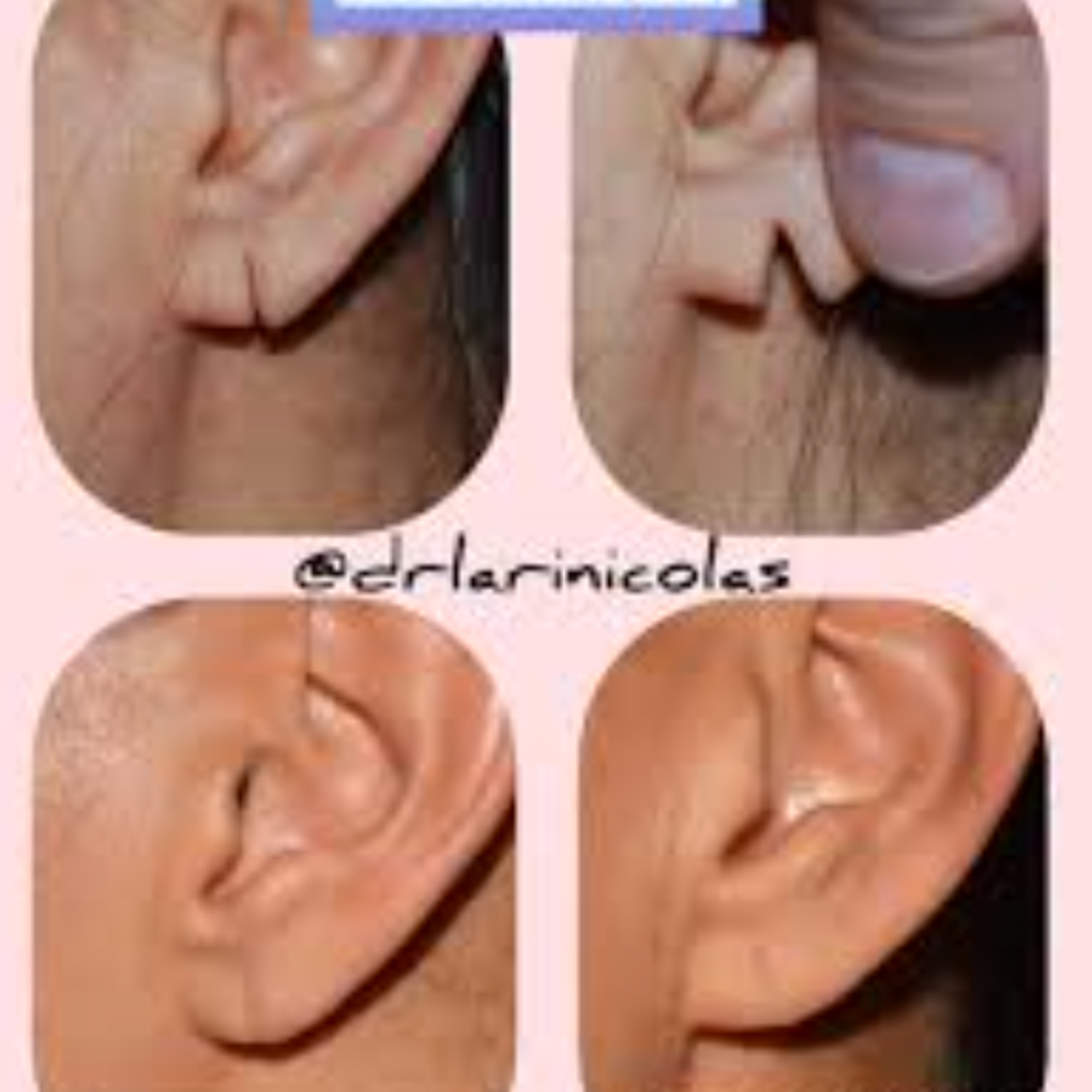 Les secrets de la chirurgie du visage