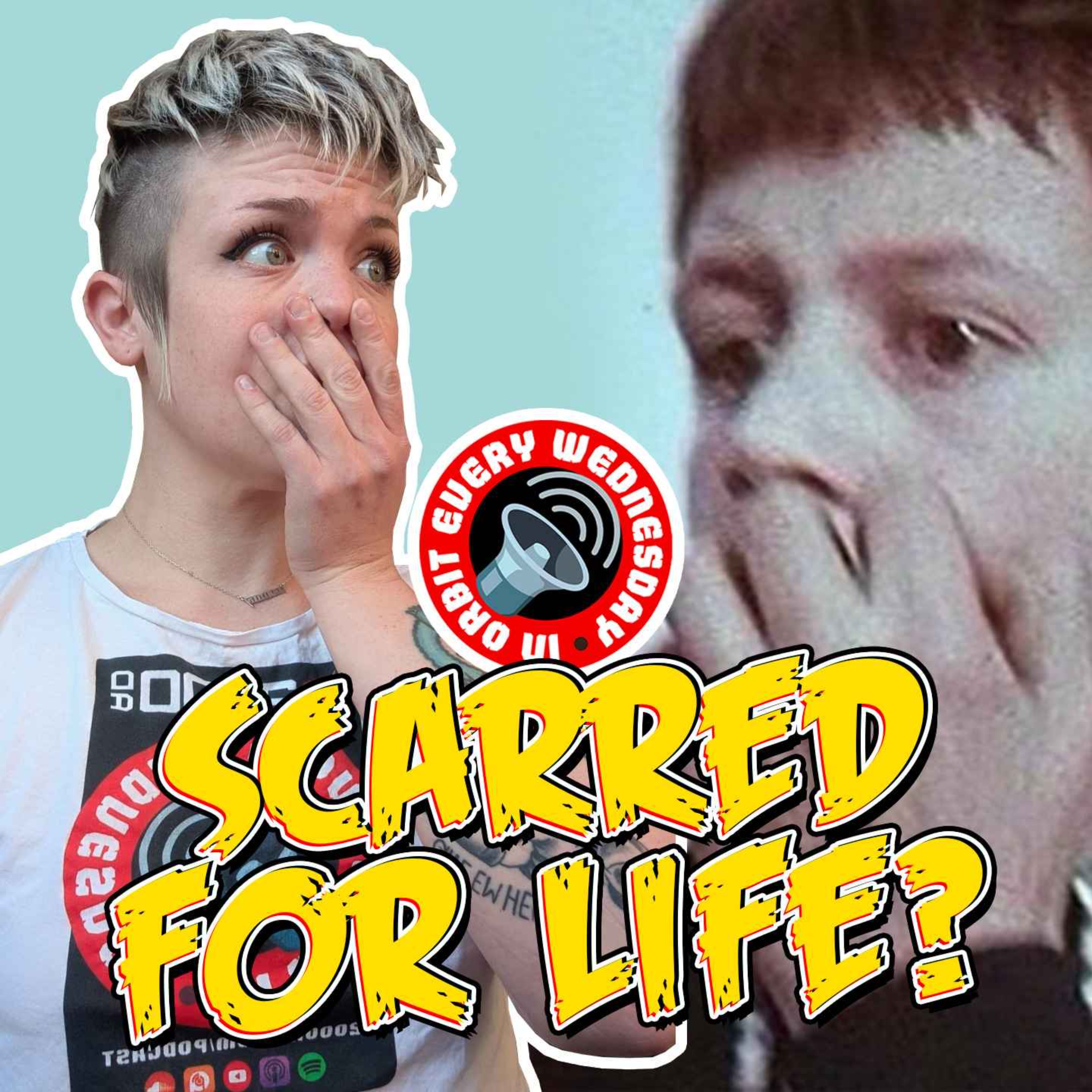 "Scarred for Life?" – In Orbit Every Wednesday