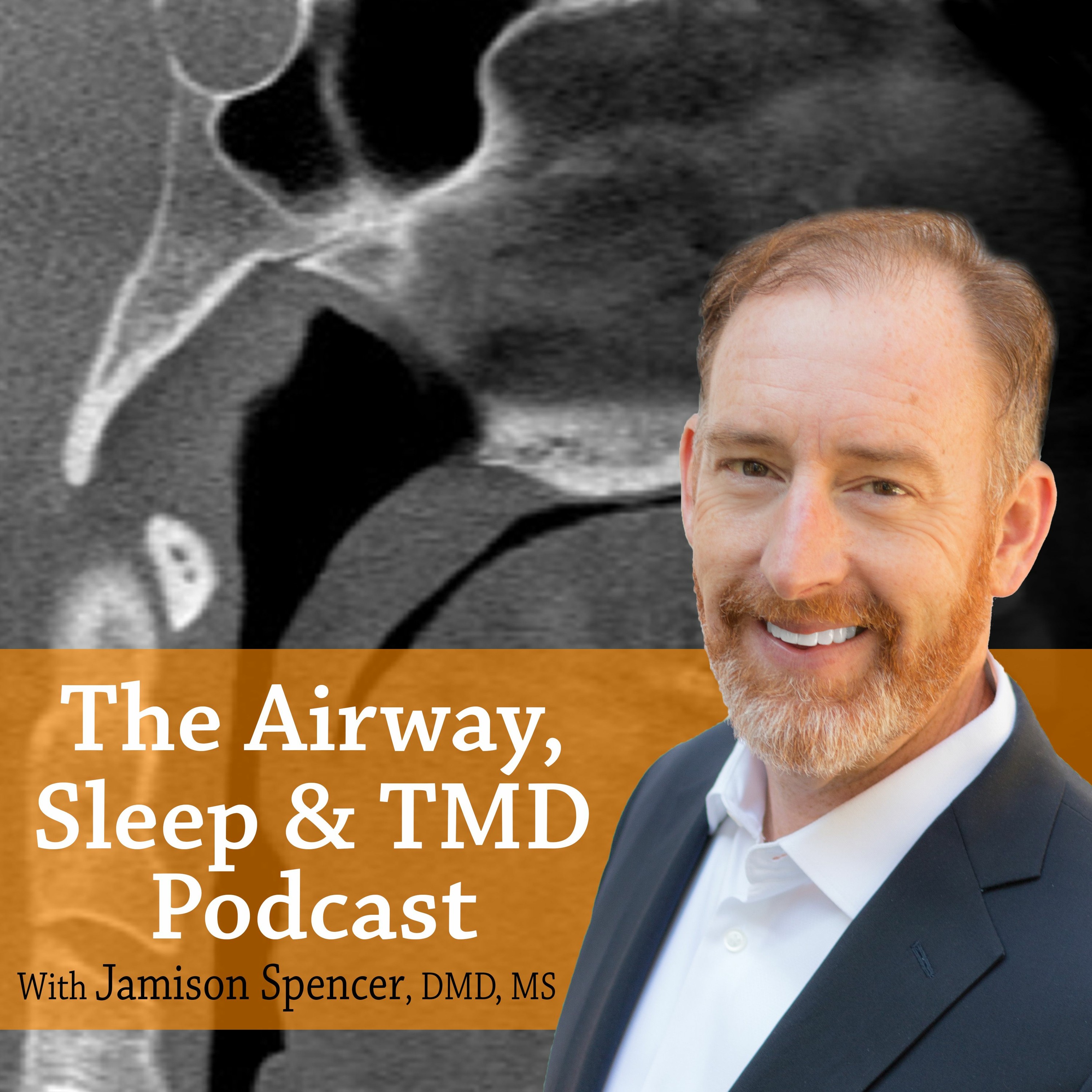 Airway, Sleep & TMD Podcast with Jamison Spencer