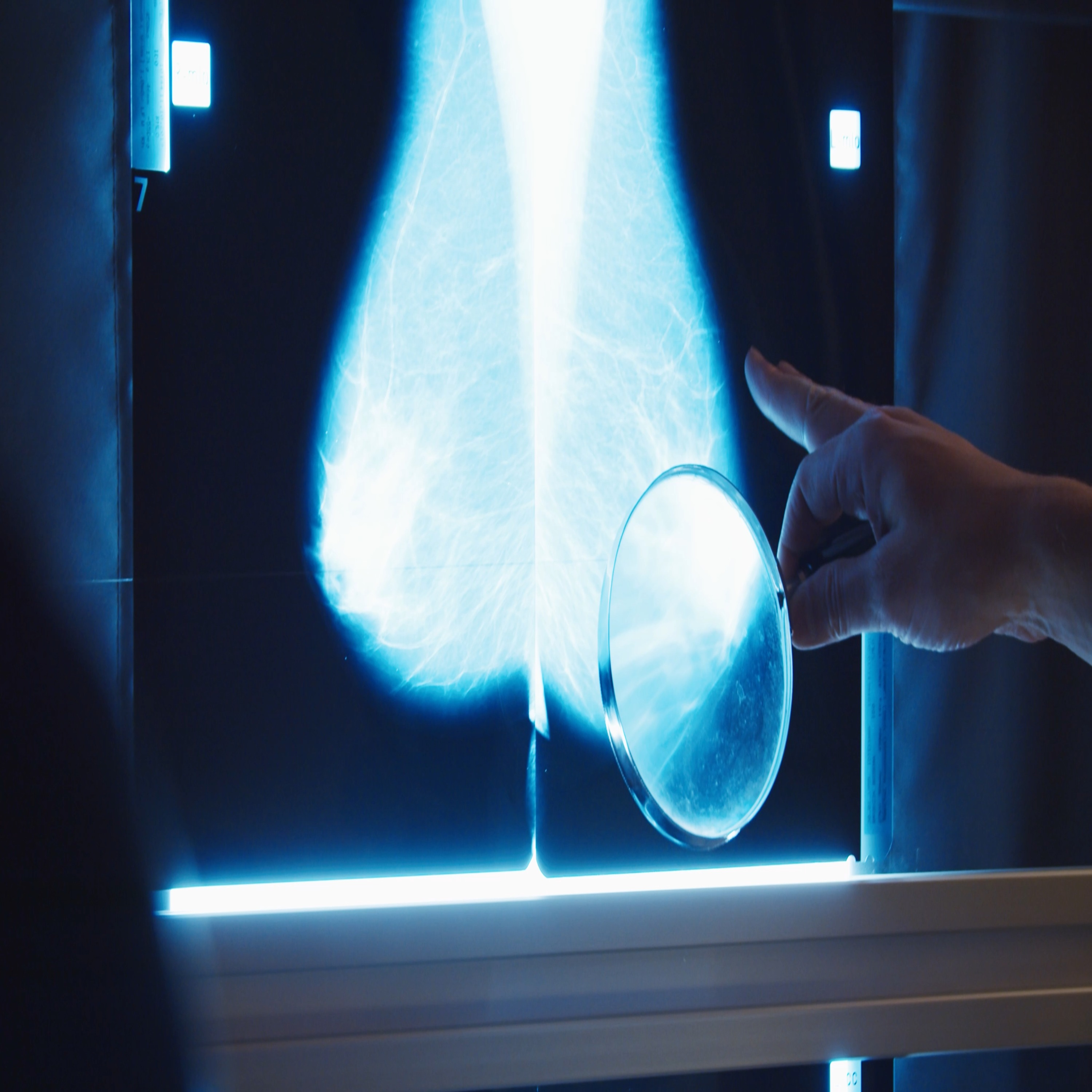 Significant Discoveries in Understanding, Preventing and Treating Breast Cancer