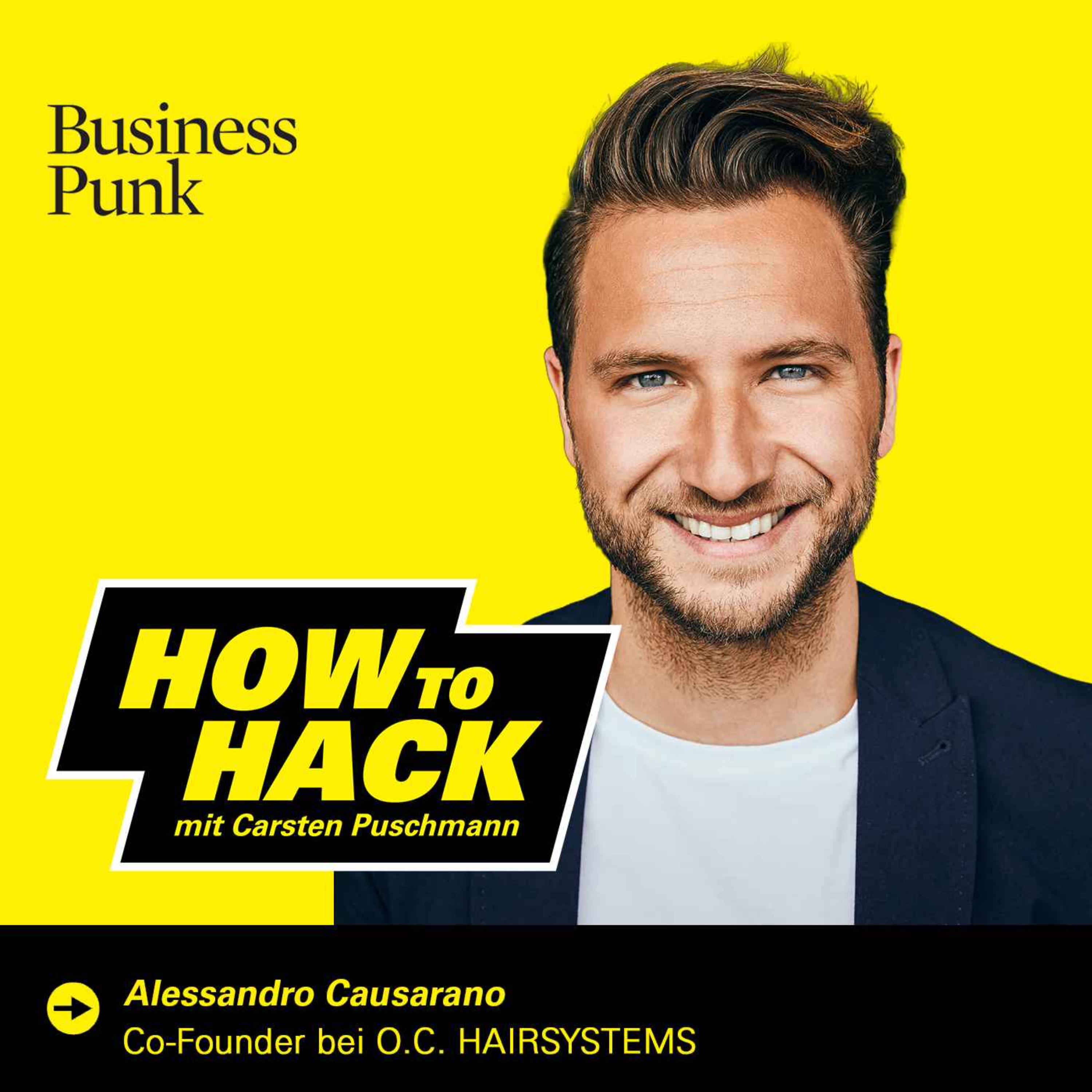 Das „Fielmann“ für Haare: Alessandro Causarano über den Aufbau einer Consumer-Health-Plattform, die den Markt für Haarausfall neu denkt.