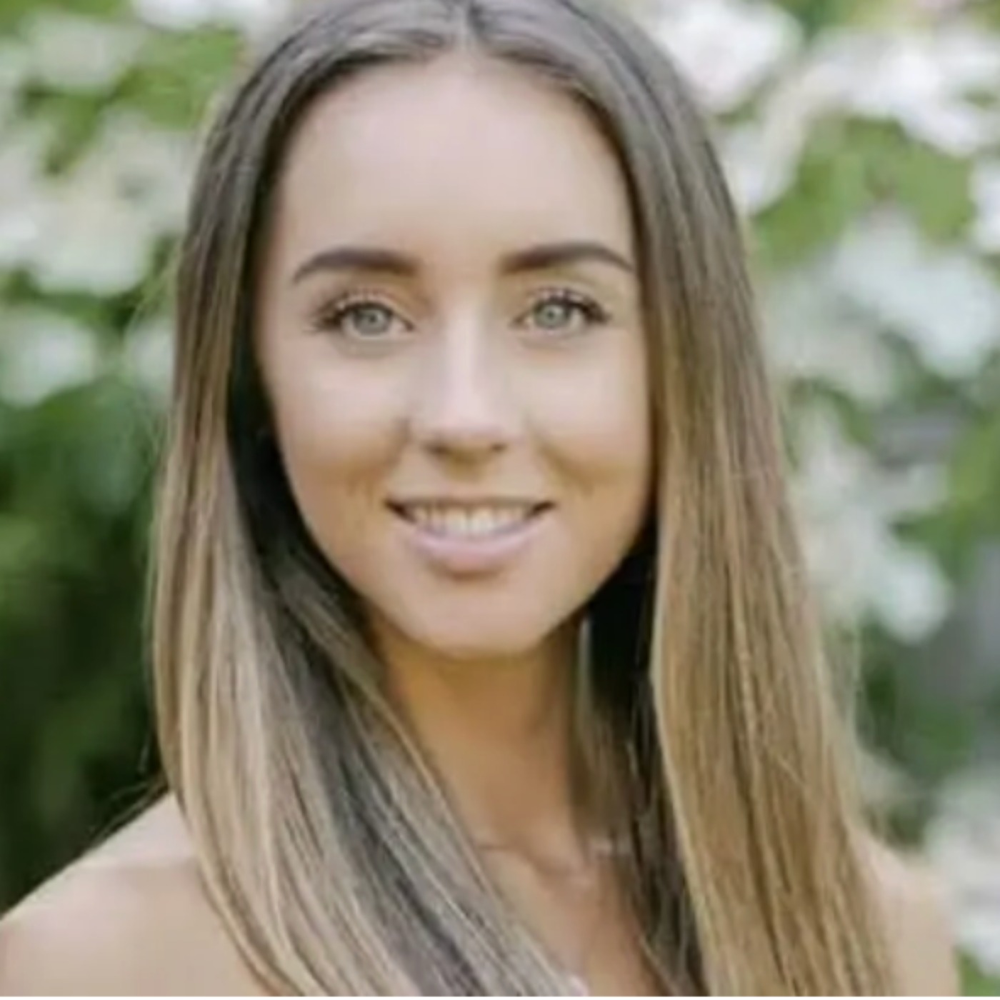 Emily Andre: I Was Really Self-Conscious With Acne