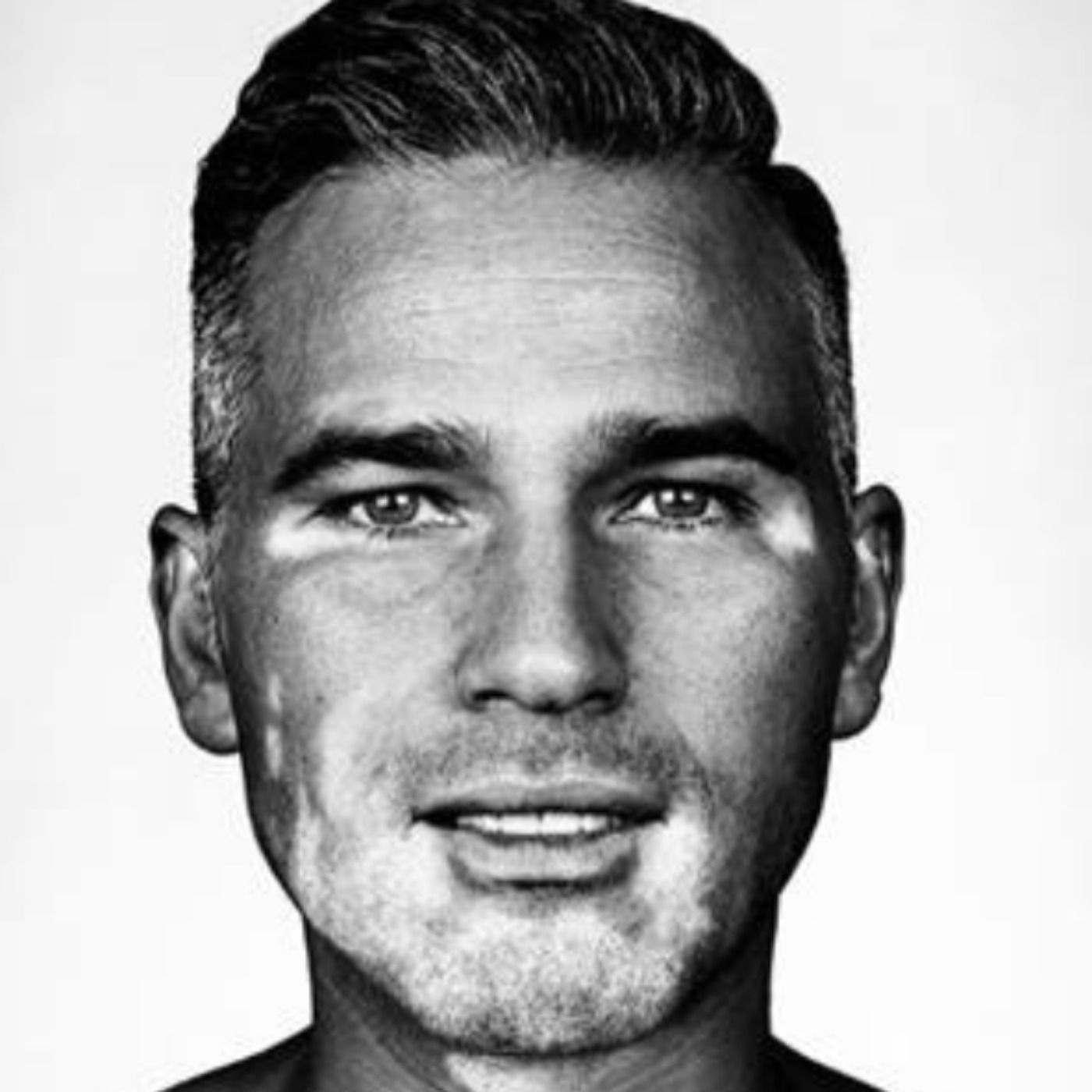 Dean Edwards: Growing Up With A Physical Difference Was Tough