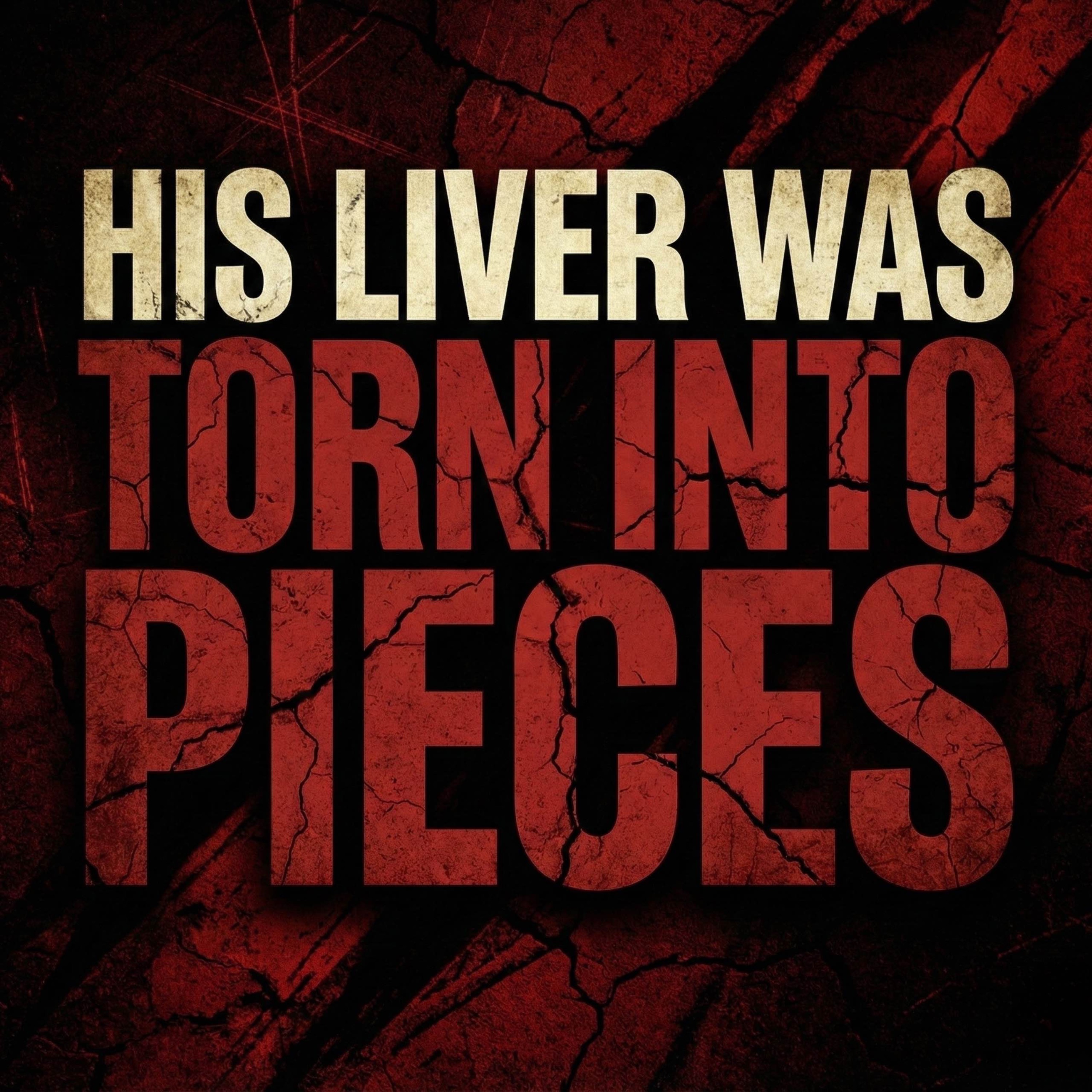 His Liver Was Torn Into Pieces | Abu Bakr Zoud