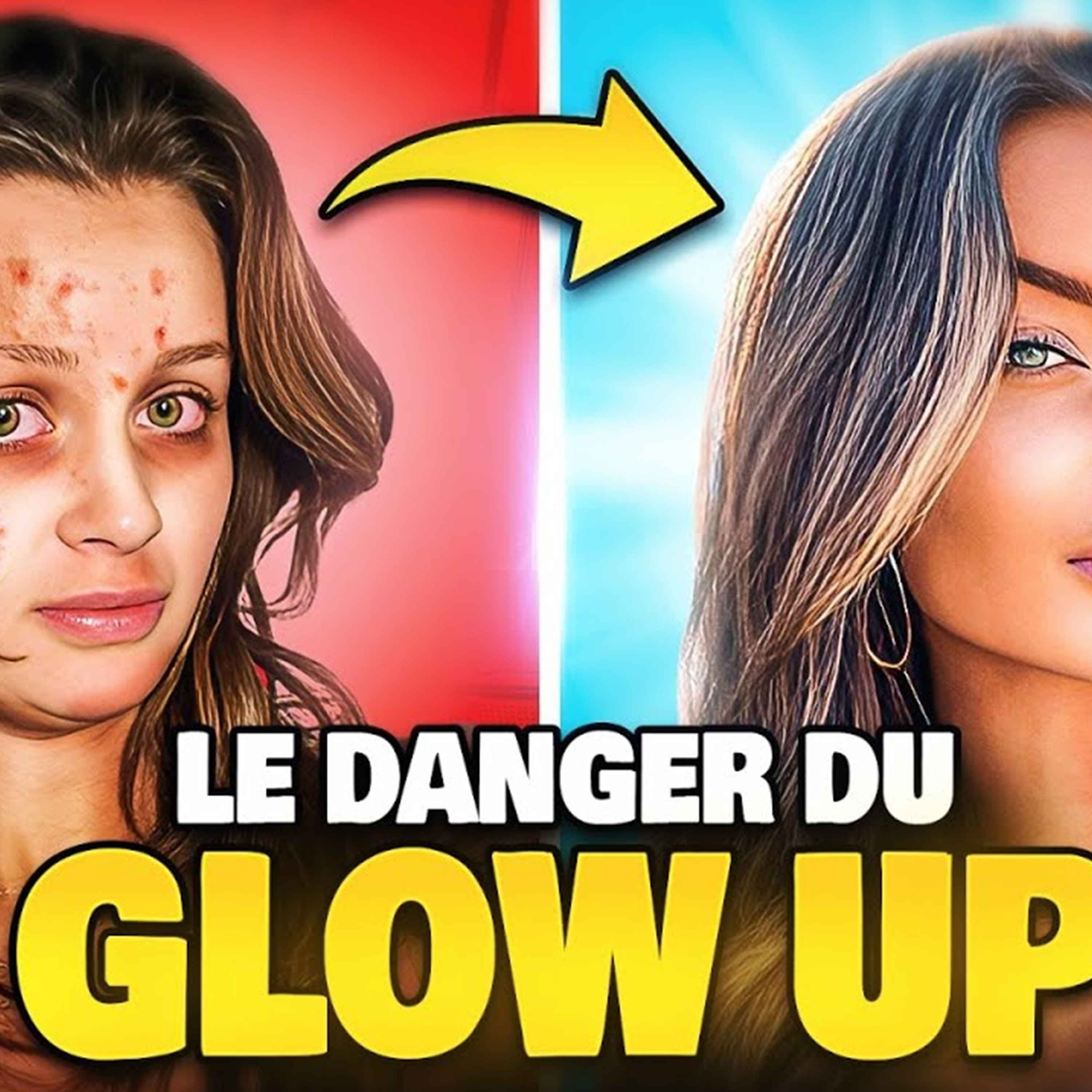 Sous Influence par Amistory - Les vidéos « Glow Up » sont DANGEREUSES (ça peut ruiner ta vie)