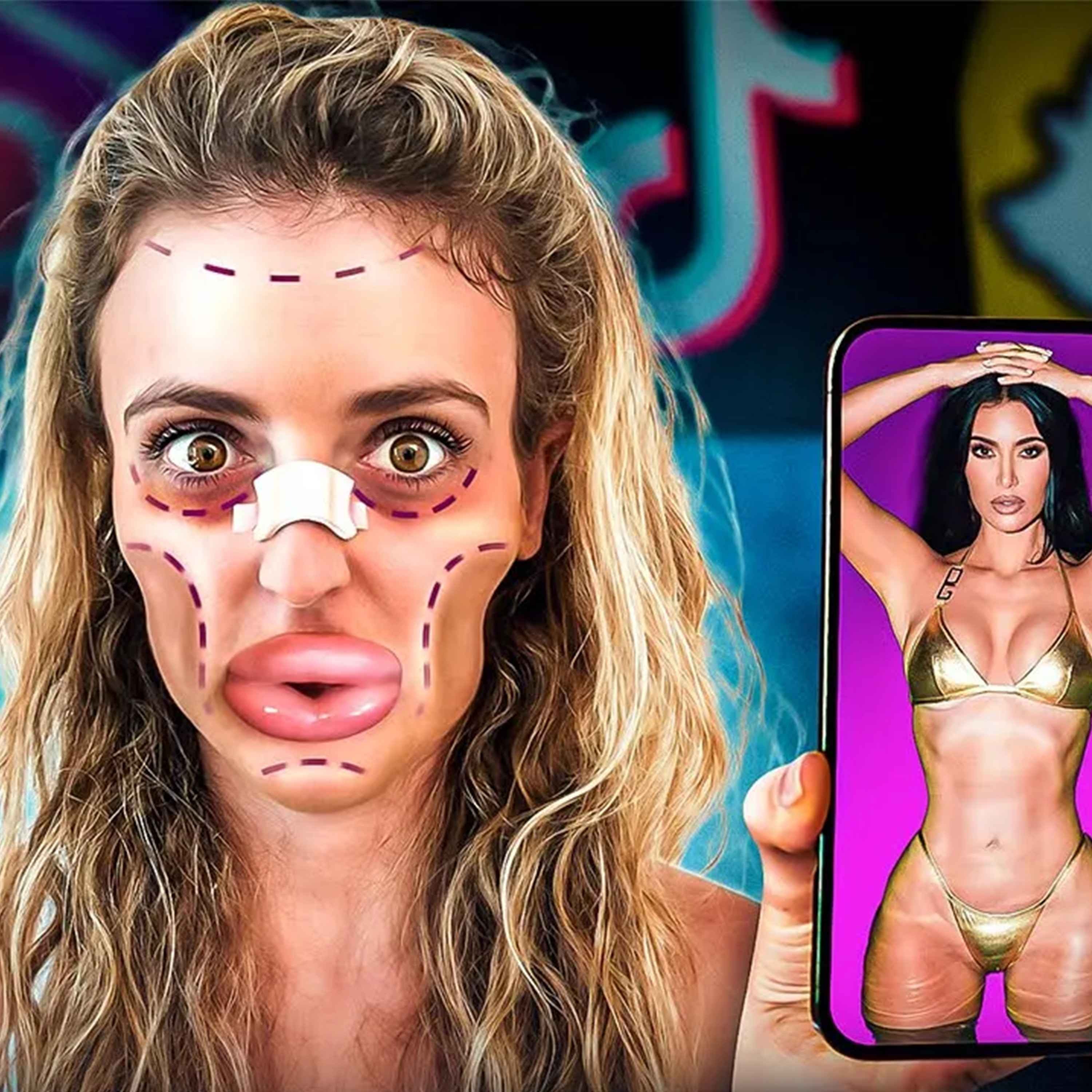 Sous Influence par Amistory - Gen Z : La génération accro à la Chirurgie Esthétique qui inquiète