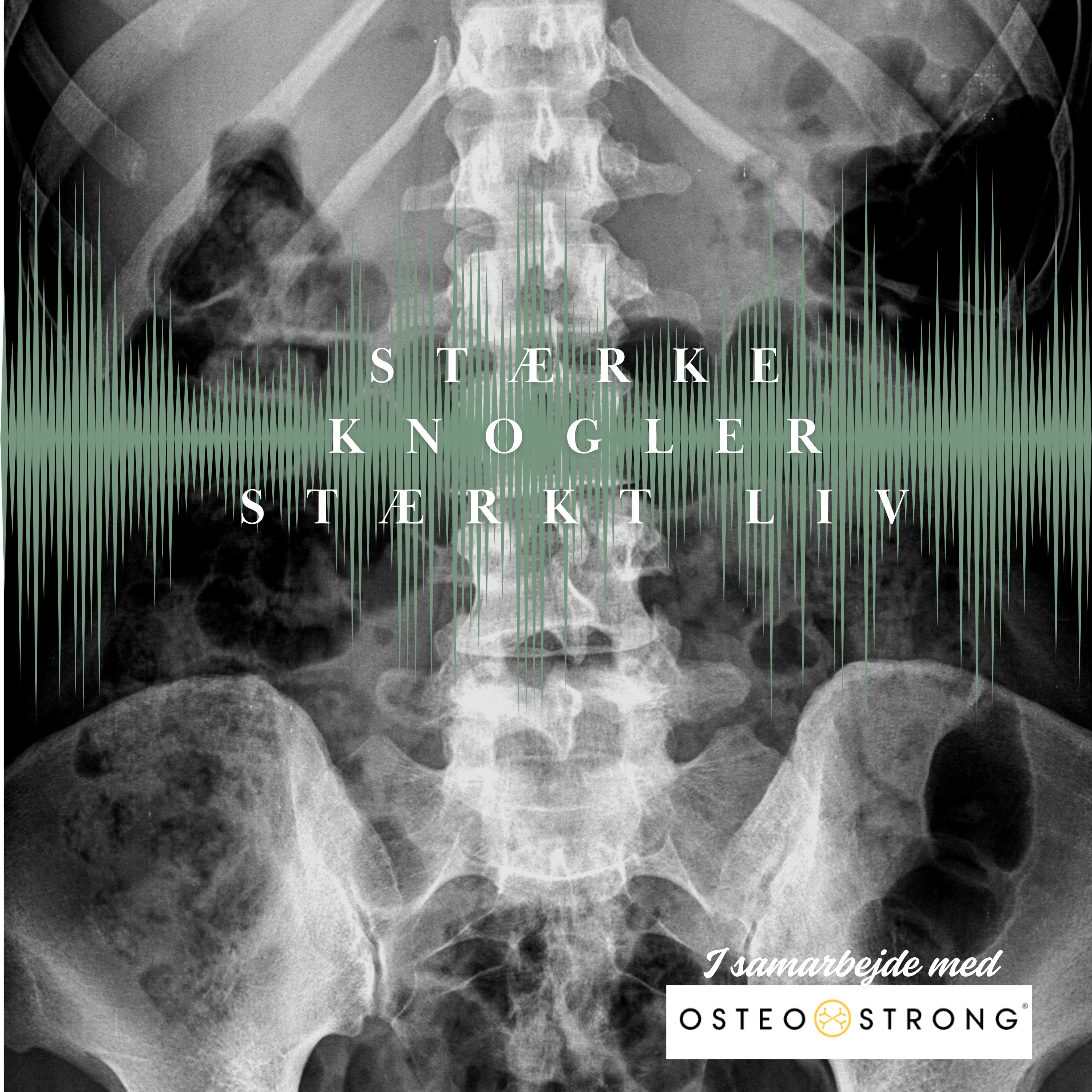 Stærke knogler - Stærkt liv af Sara Maria Franch-Mærkedahl