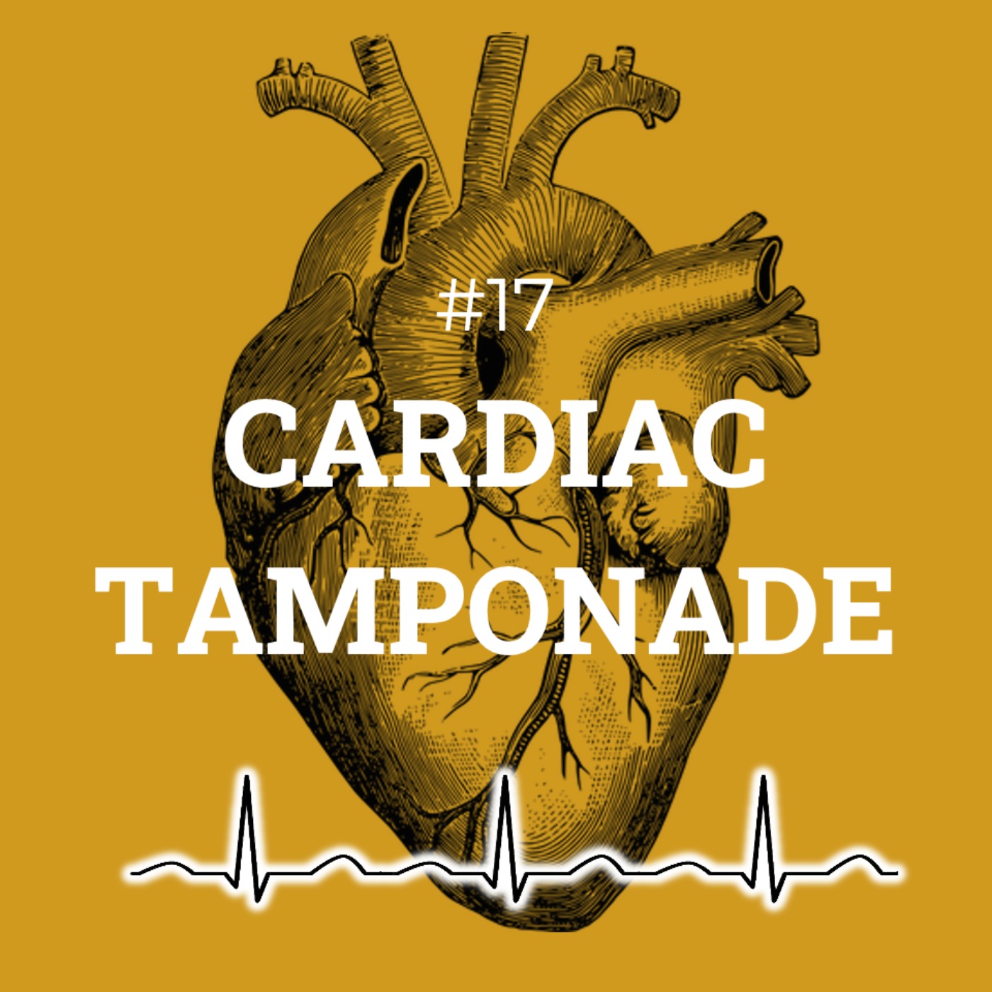 #17 Cardiac tamponade episode artwork