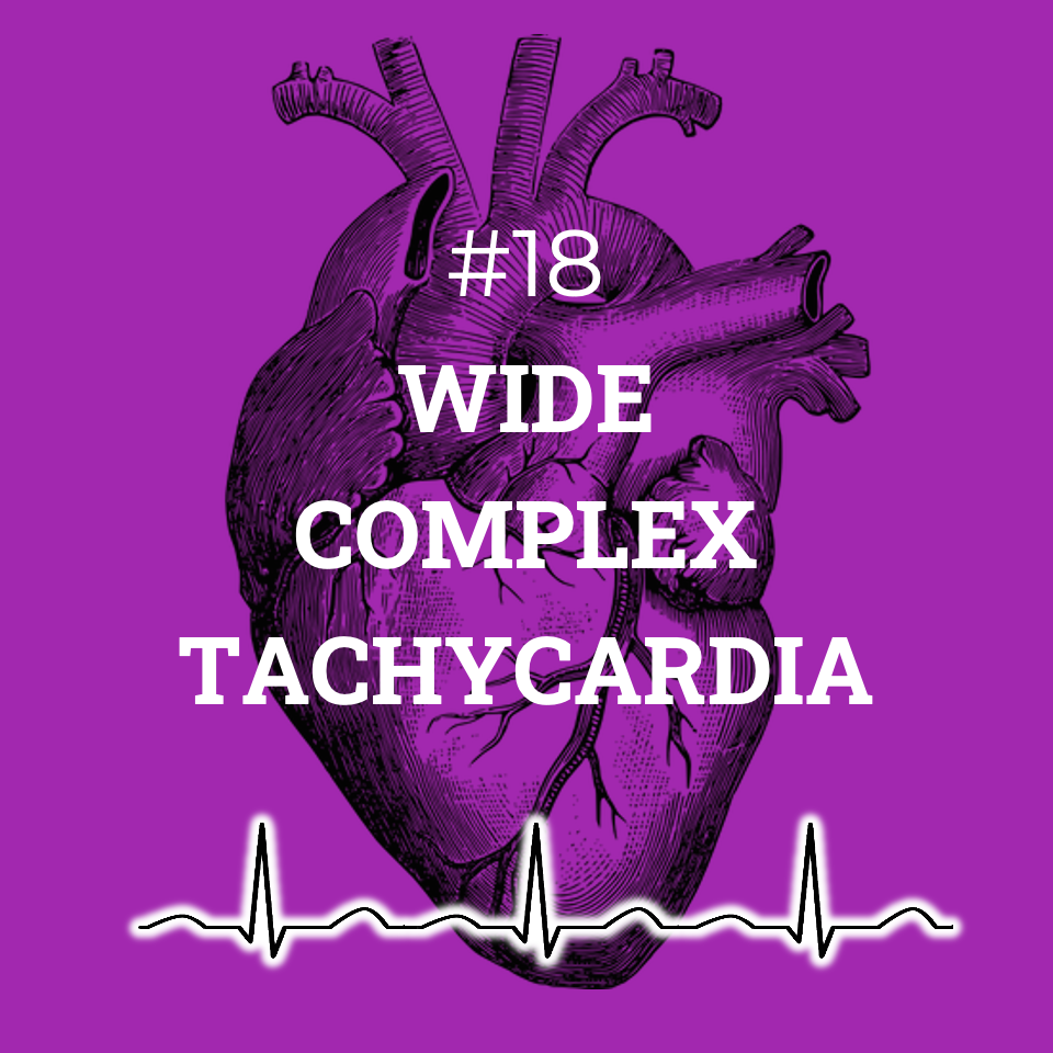 #18 Wide complex tachycardia