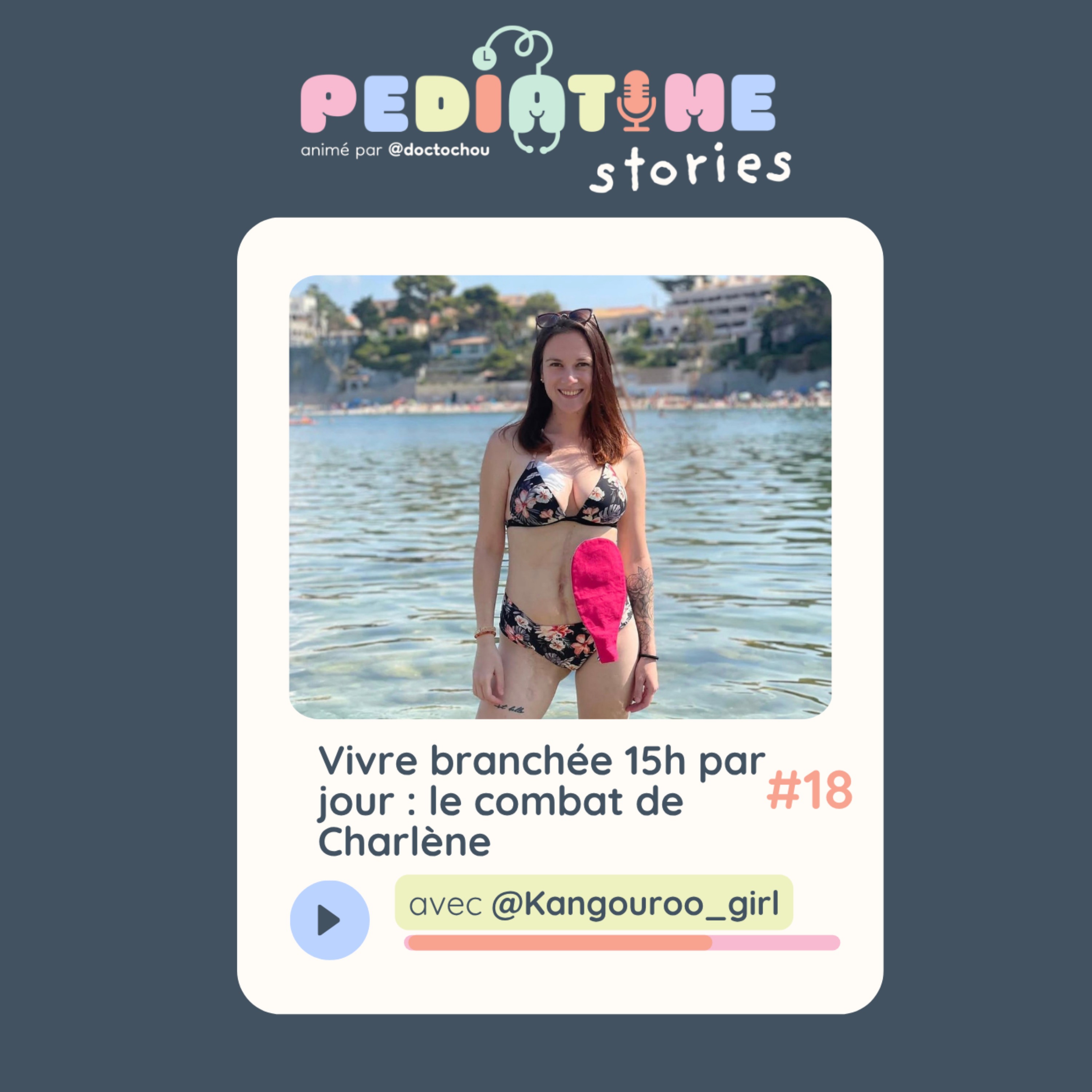 #18 Vivre branchée 15h par jour et avec une stomie : le Combat de charlène