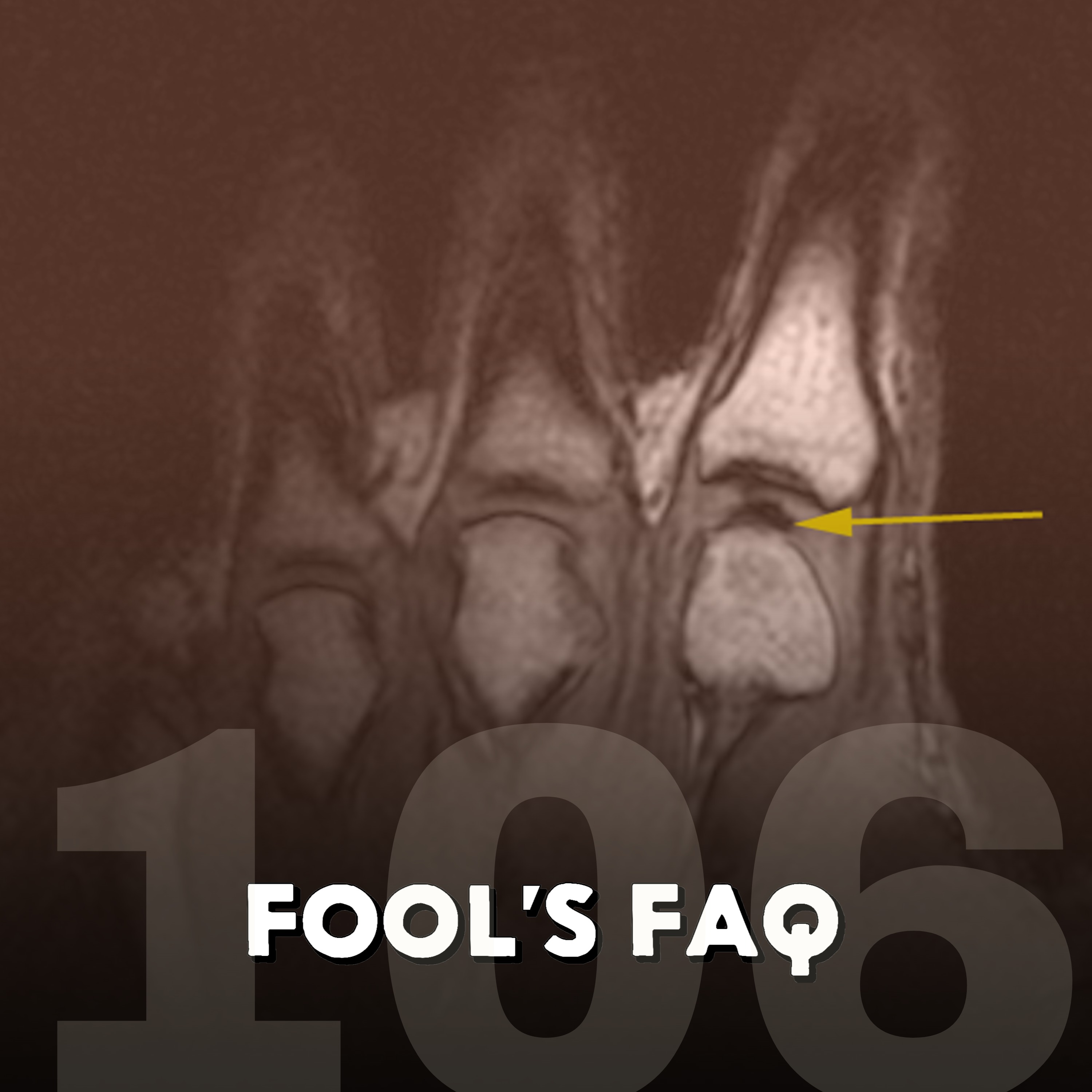 Is Cracking Your Knuckles Really Bad for You? (Refresher) episode artwork