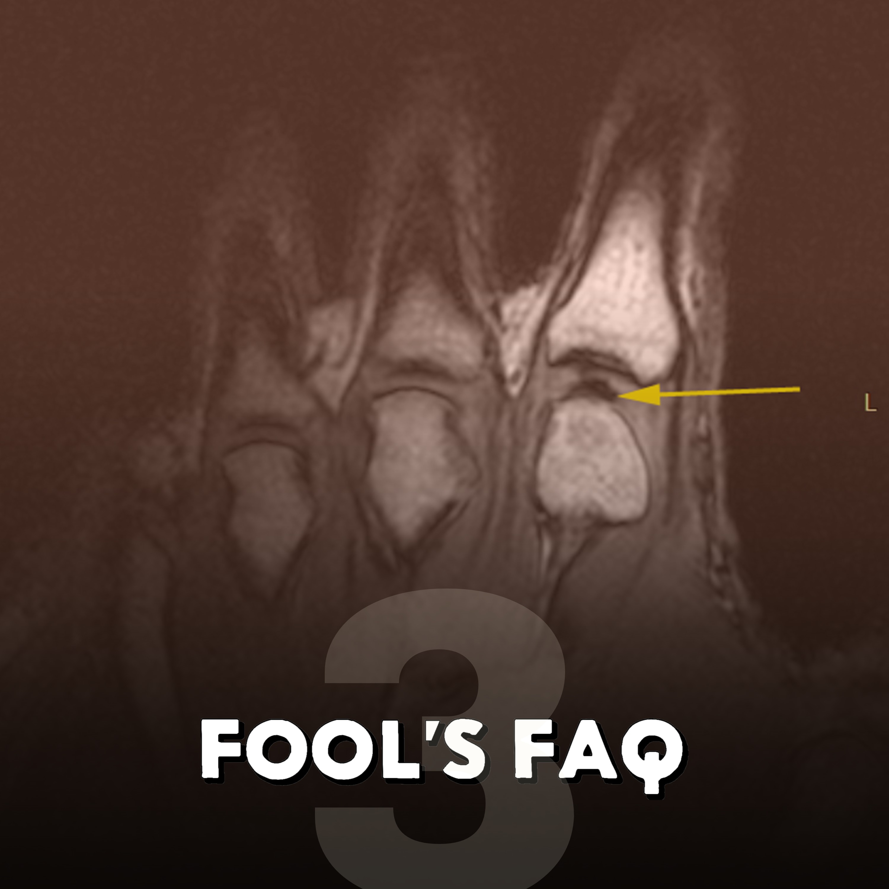 Is Cracking Your Knuckles Really Bad for You? episode artwork