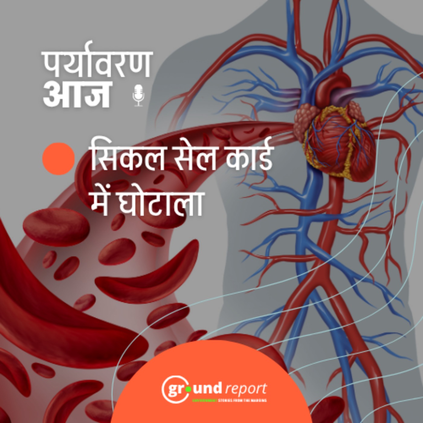 मध्य प्रदेश में सिर्फ कागजों में बंटे सिकल सेल कार्ड episode artwork
