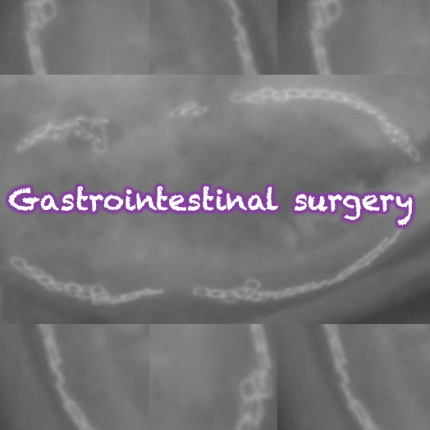 151 Gastrointestinal surgery