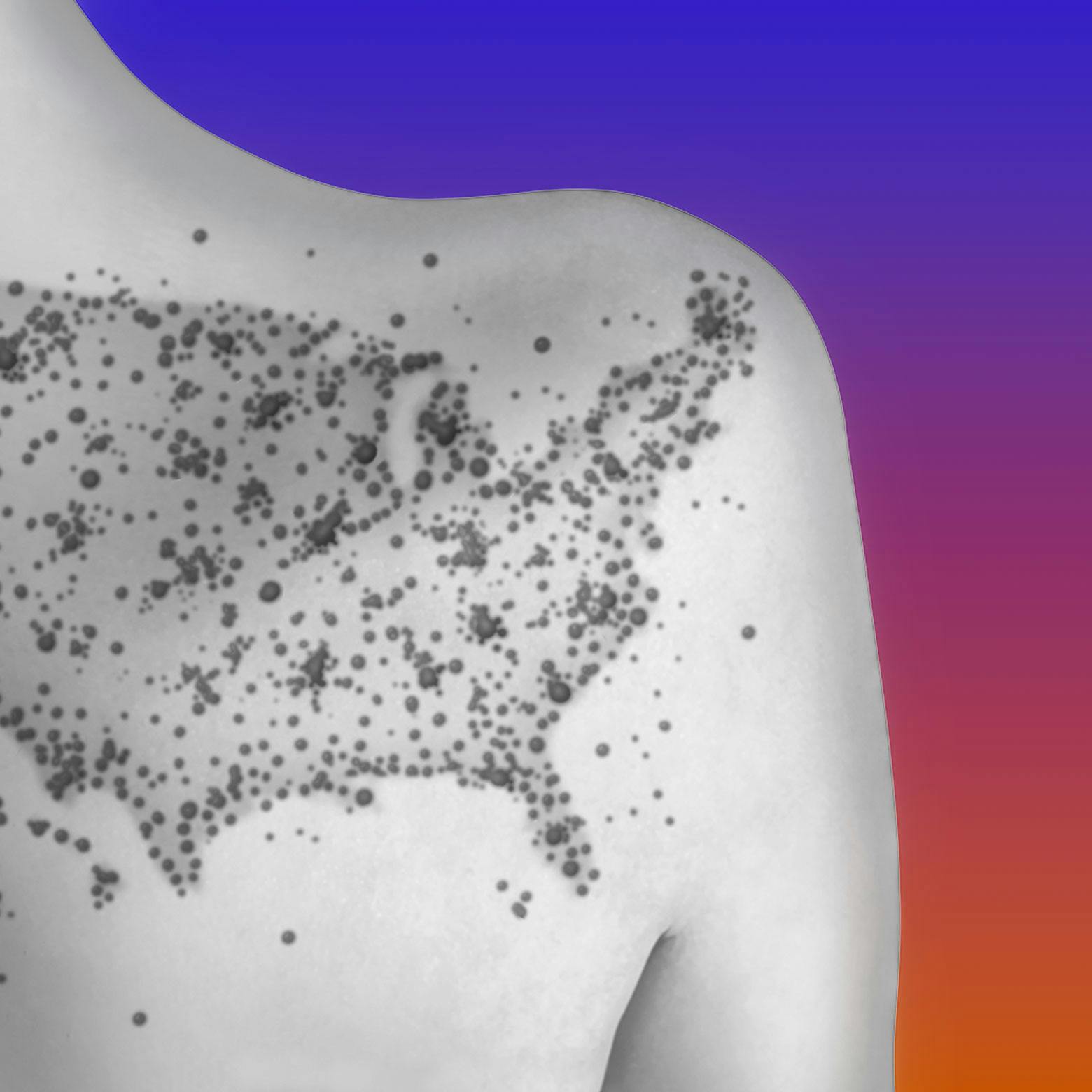 What Next: TBD | Tech, power, and the future - Hot Measles Summer