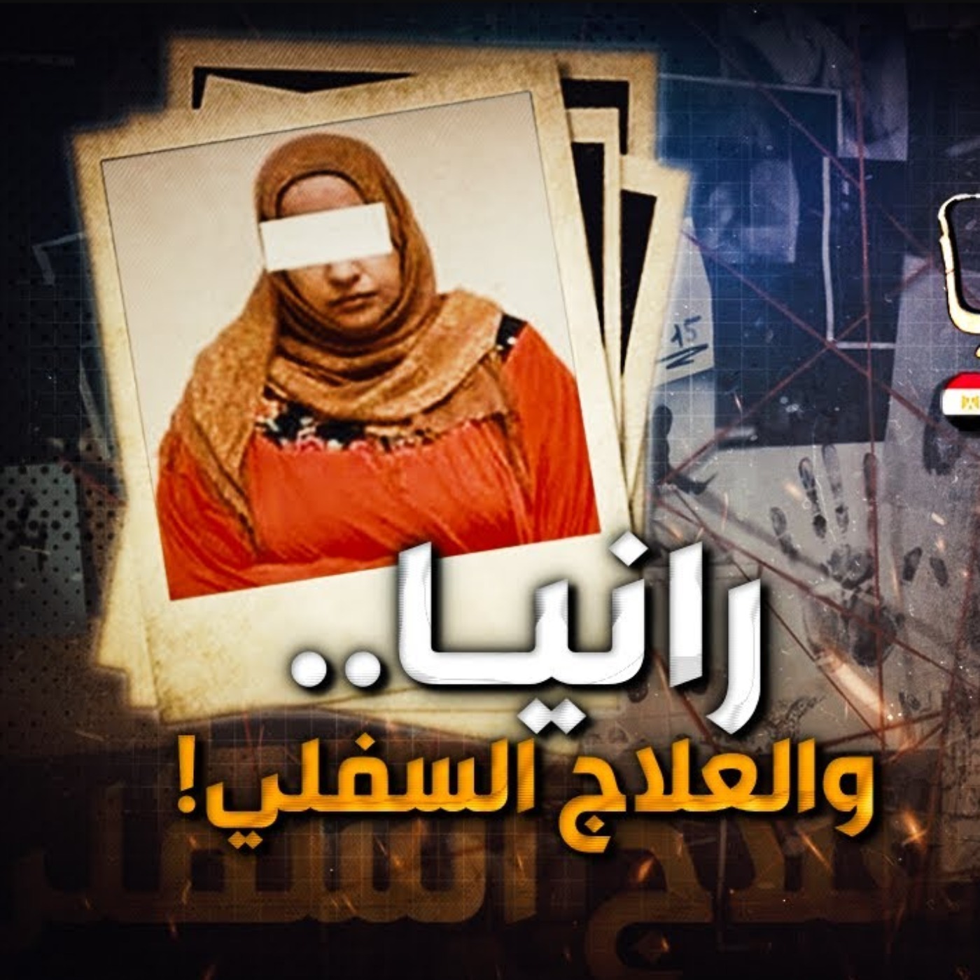 رانيا والعلاج السفلي