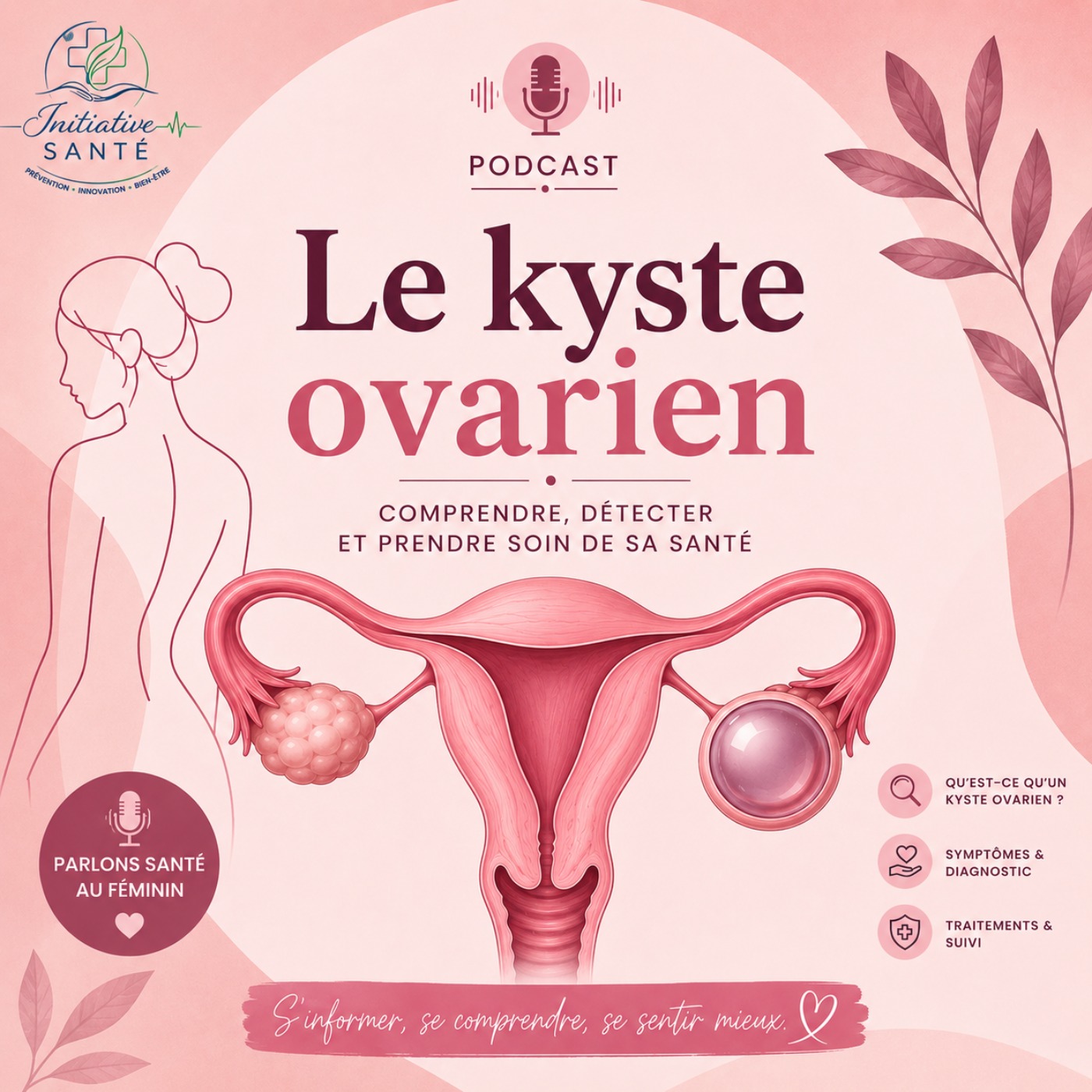Les maladies gynécologiques : comprendre les kystes ovariens