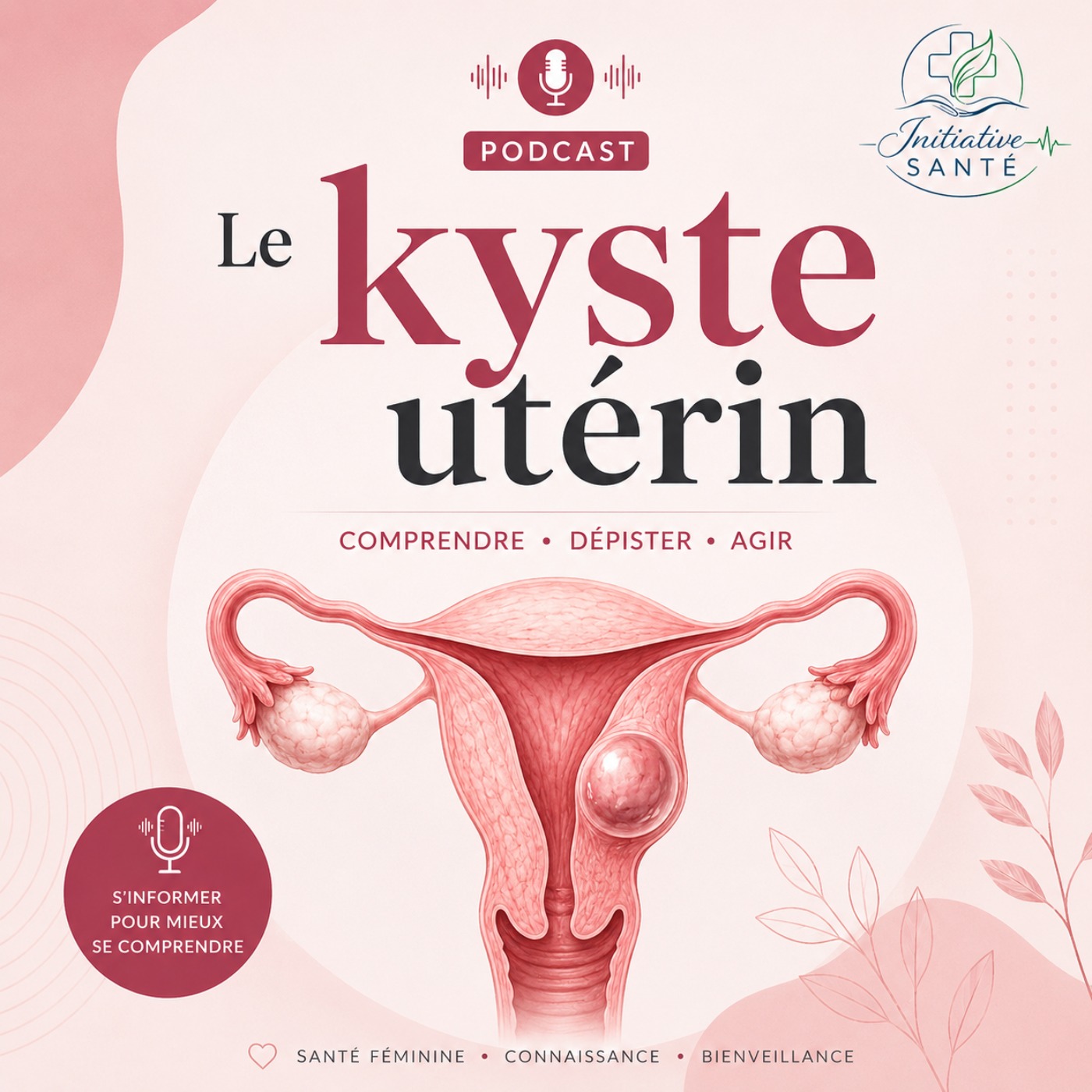 Kyste utérin : comprendre ce qu'il faut savoir