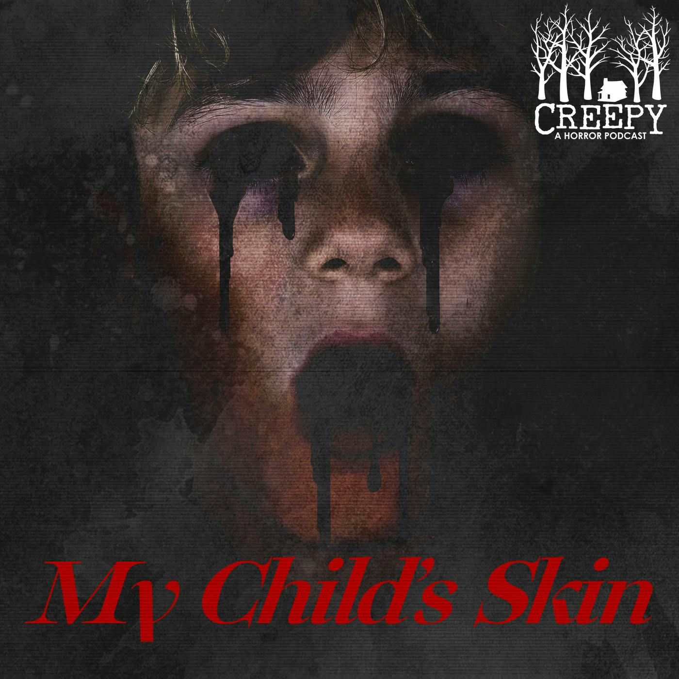 My Child's Skin