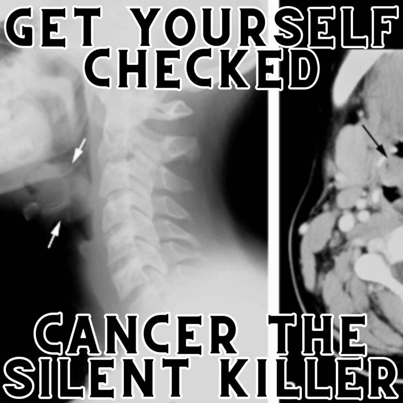 Get Yourself Checked, Cancer Is A Silent Killer episode artwork