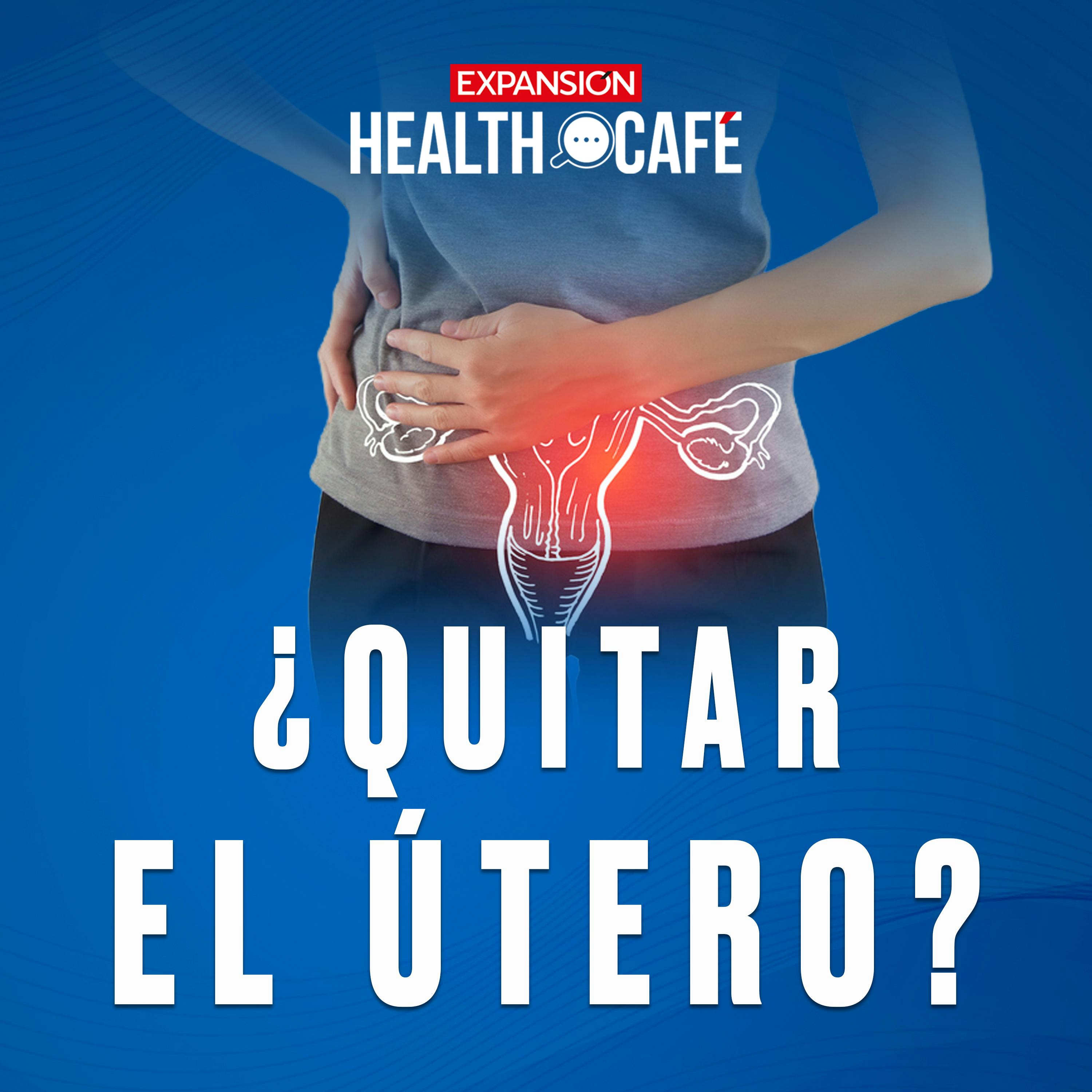 Histerectomía: lo que sí tienes que saber