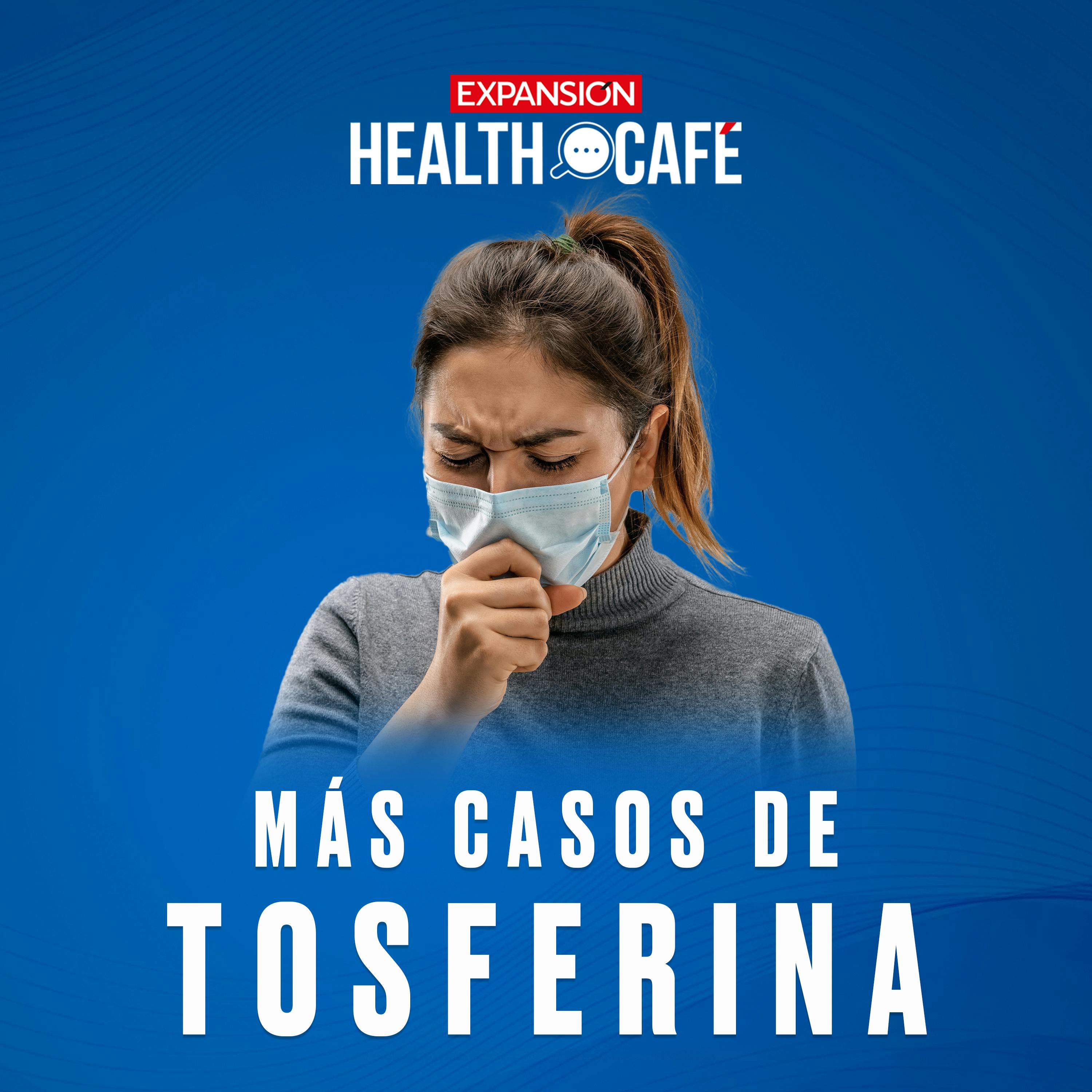 Brote de tosferina: cómo prevenirla y tratarla