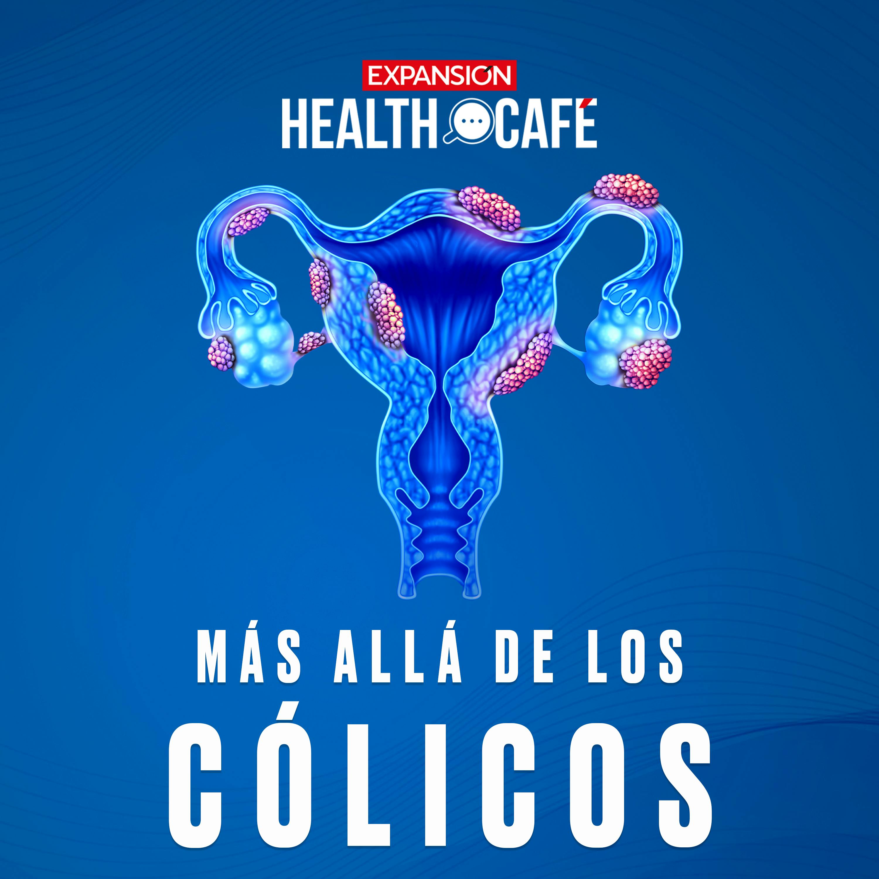 Endometriosis: el dolor invisible