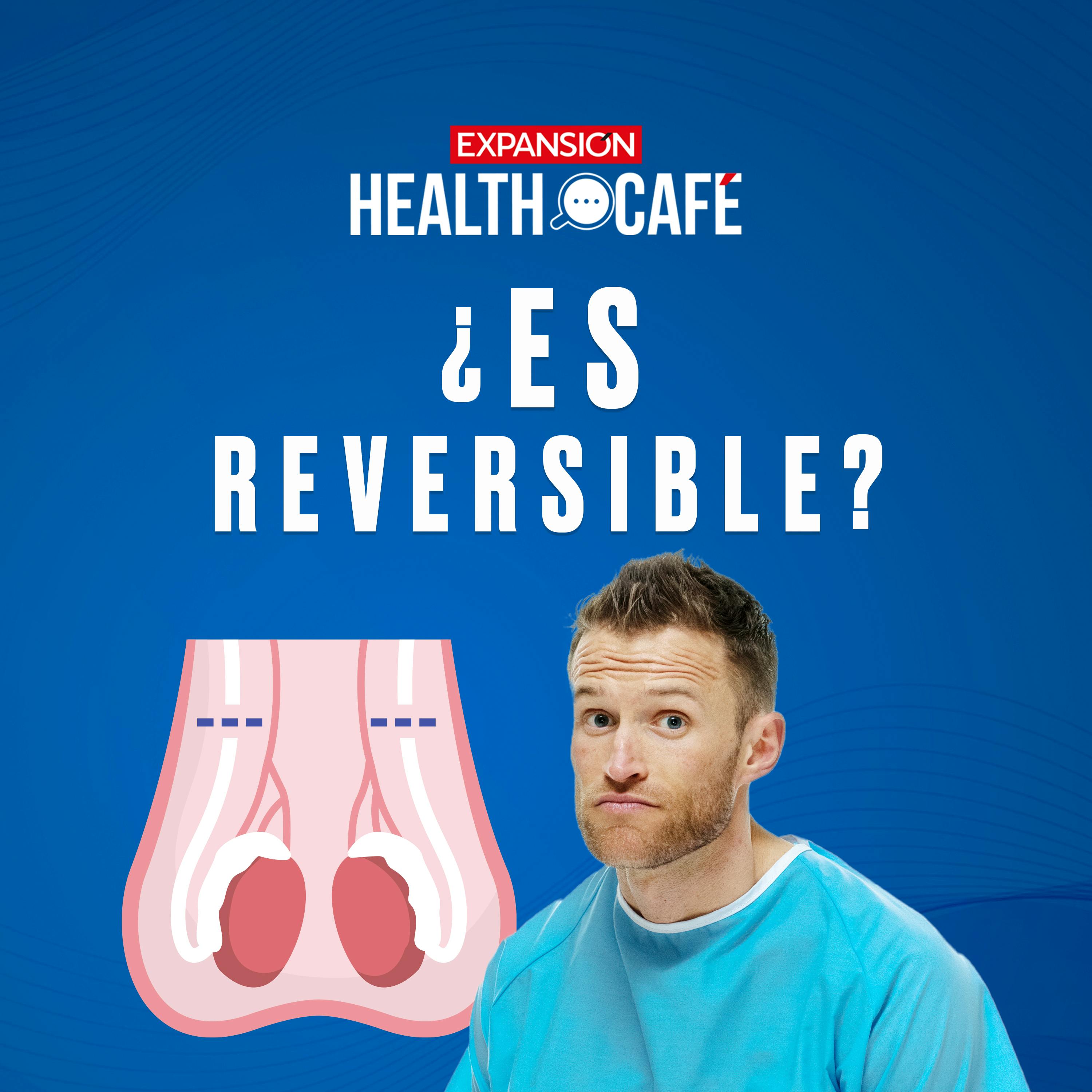 Mitos y realidades de la vasectomía
