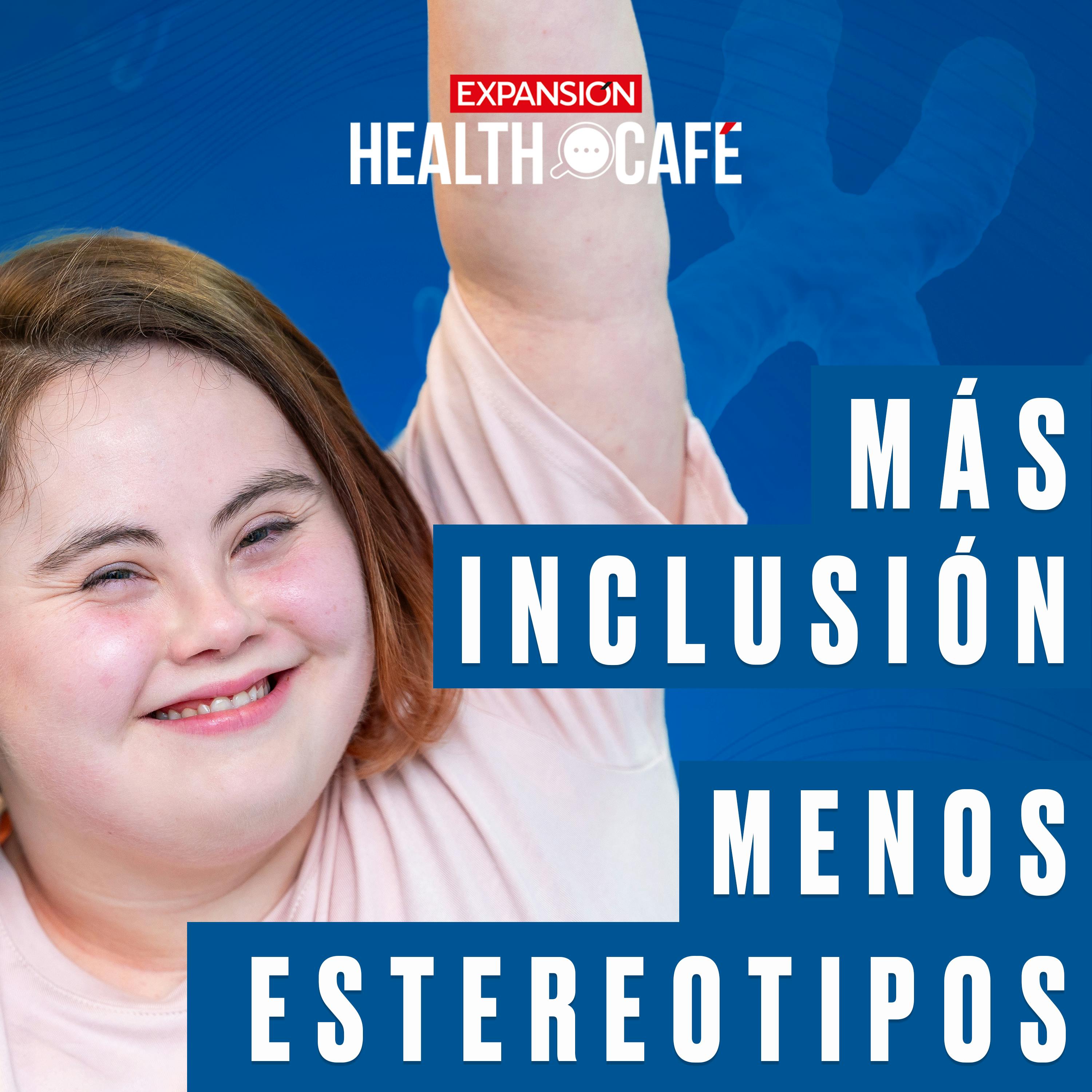 Síndrome de Down, lo que nadie te cuenta
