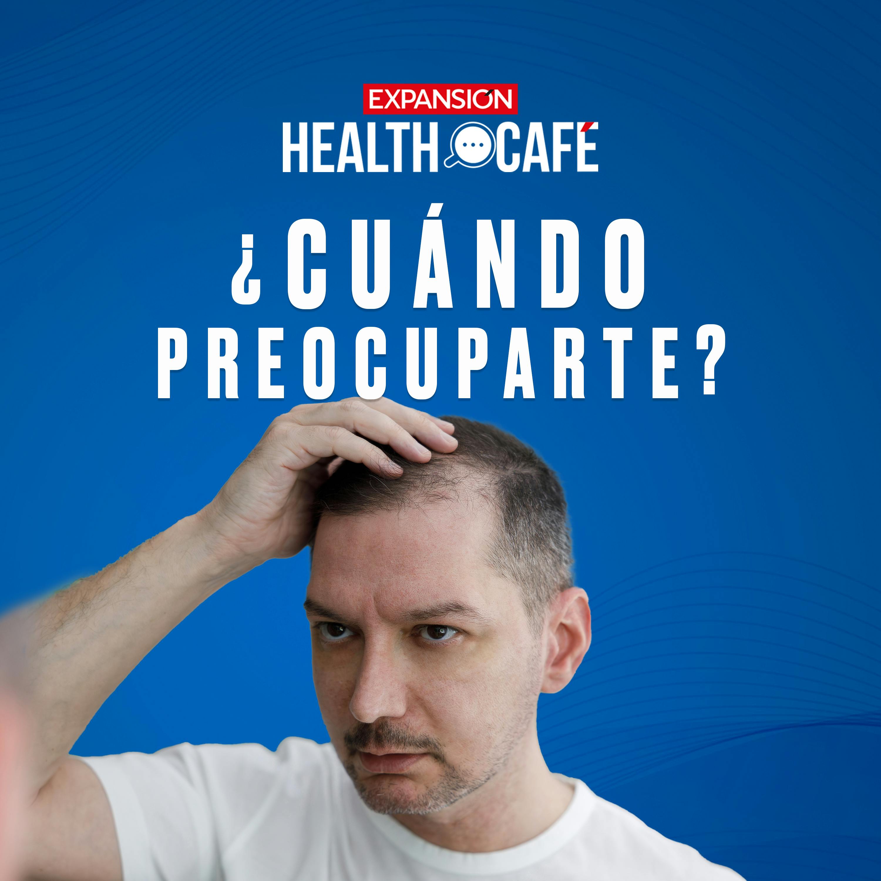 RECORDANDO: Las red flags de la caída de cabello