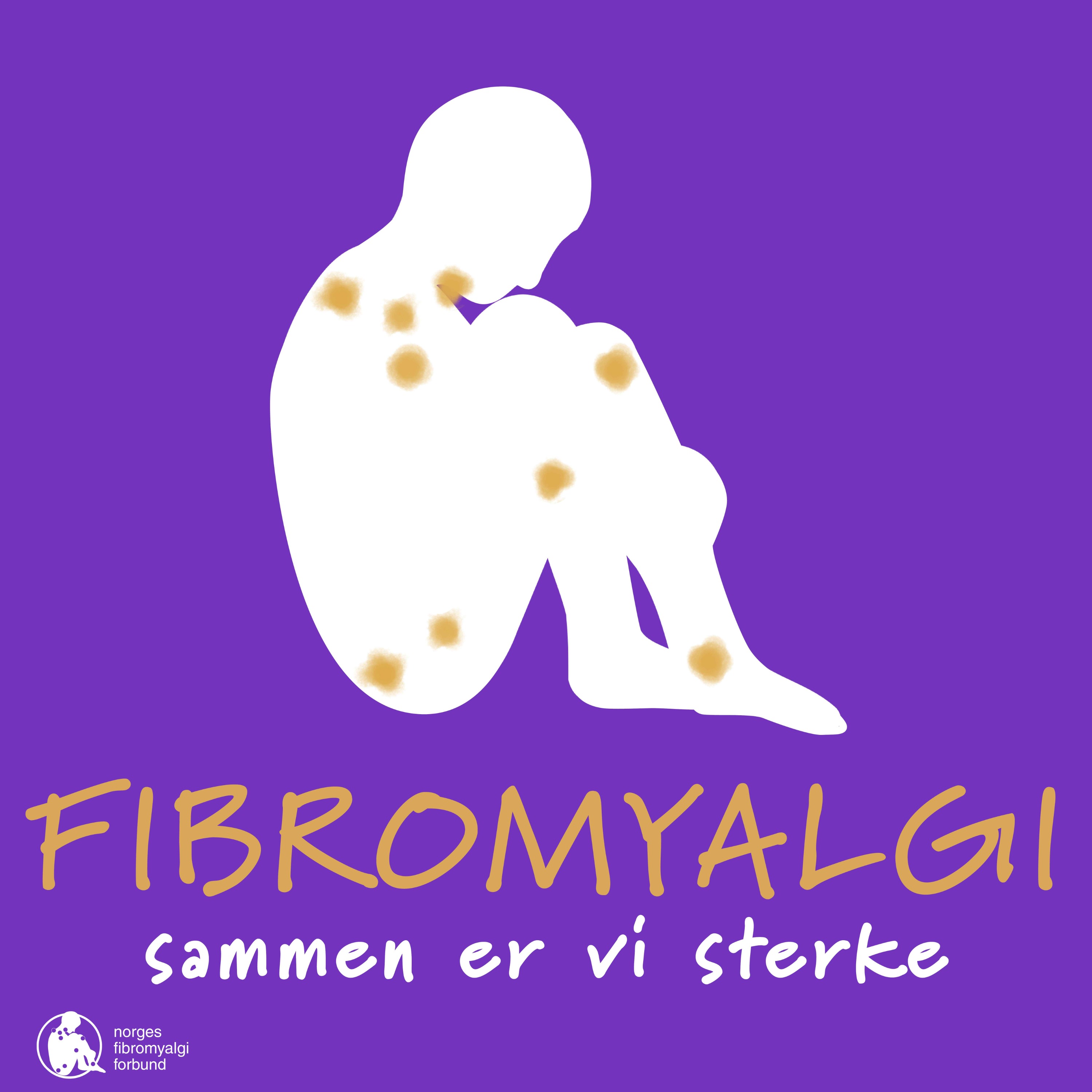 Fibromyalgi